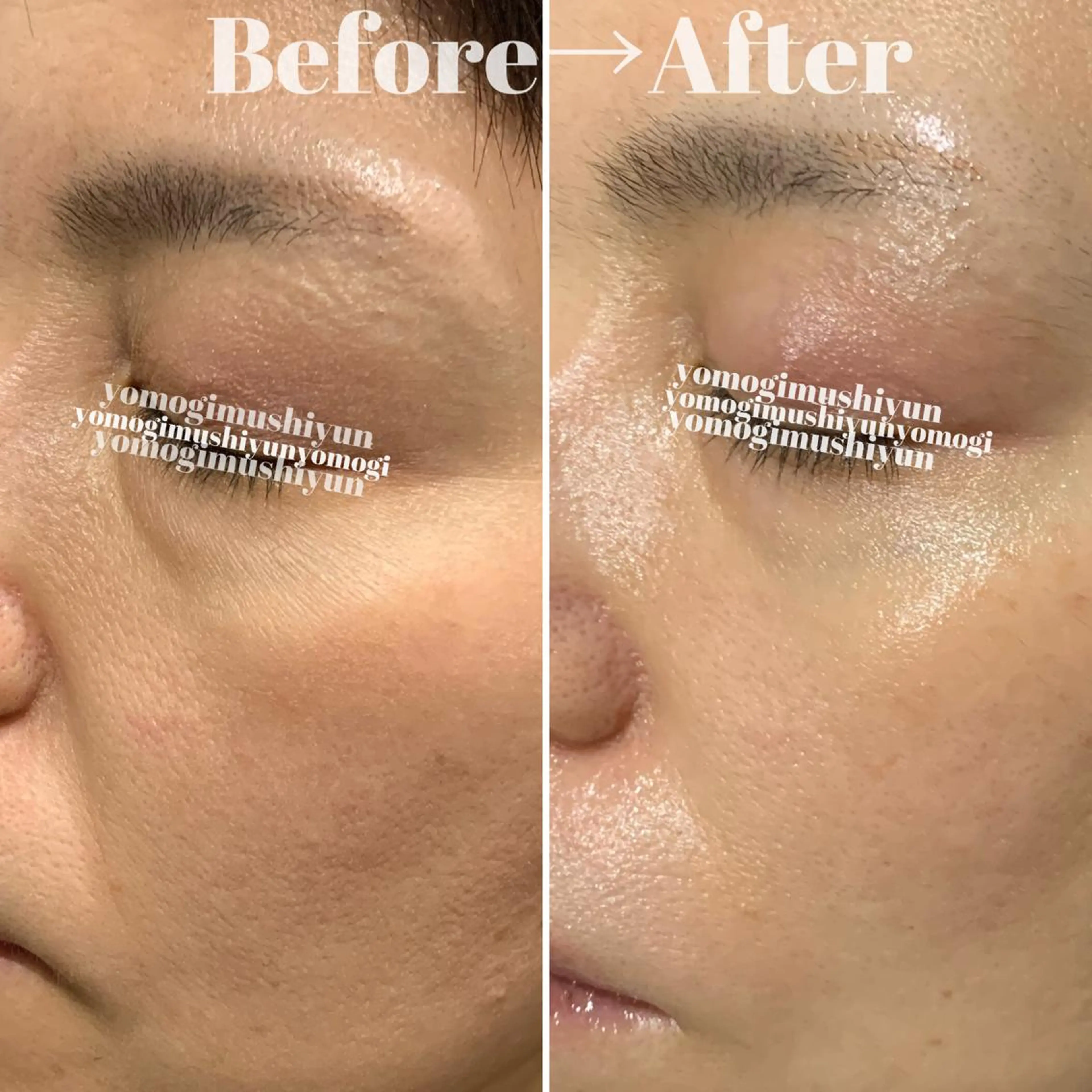 エステ よもぎ蒸しエステサロン★yun所属・よもぎ蒸しサロン ゆんのエステ・リラクイメージ