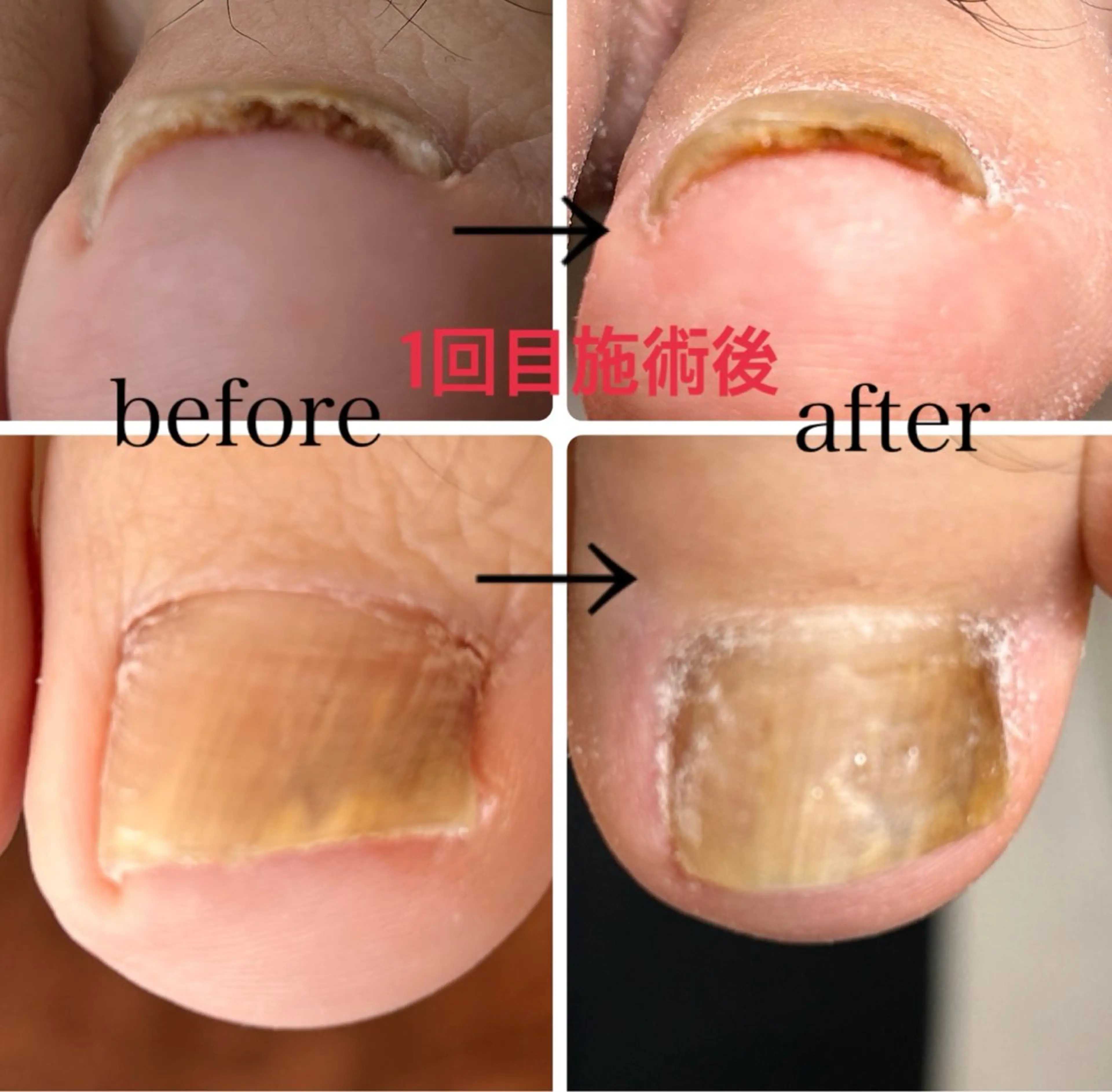 その他(ネイル) N.style所属・Ｎ. styleのネイルデザイン