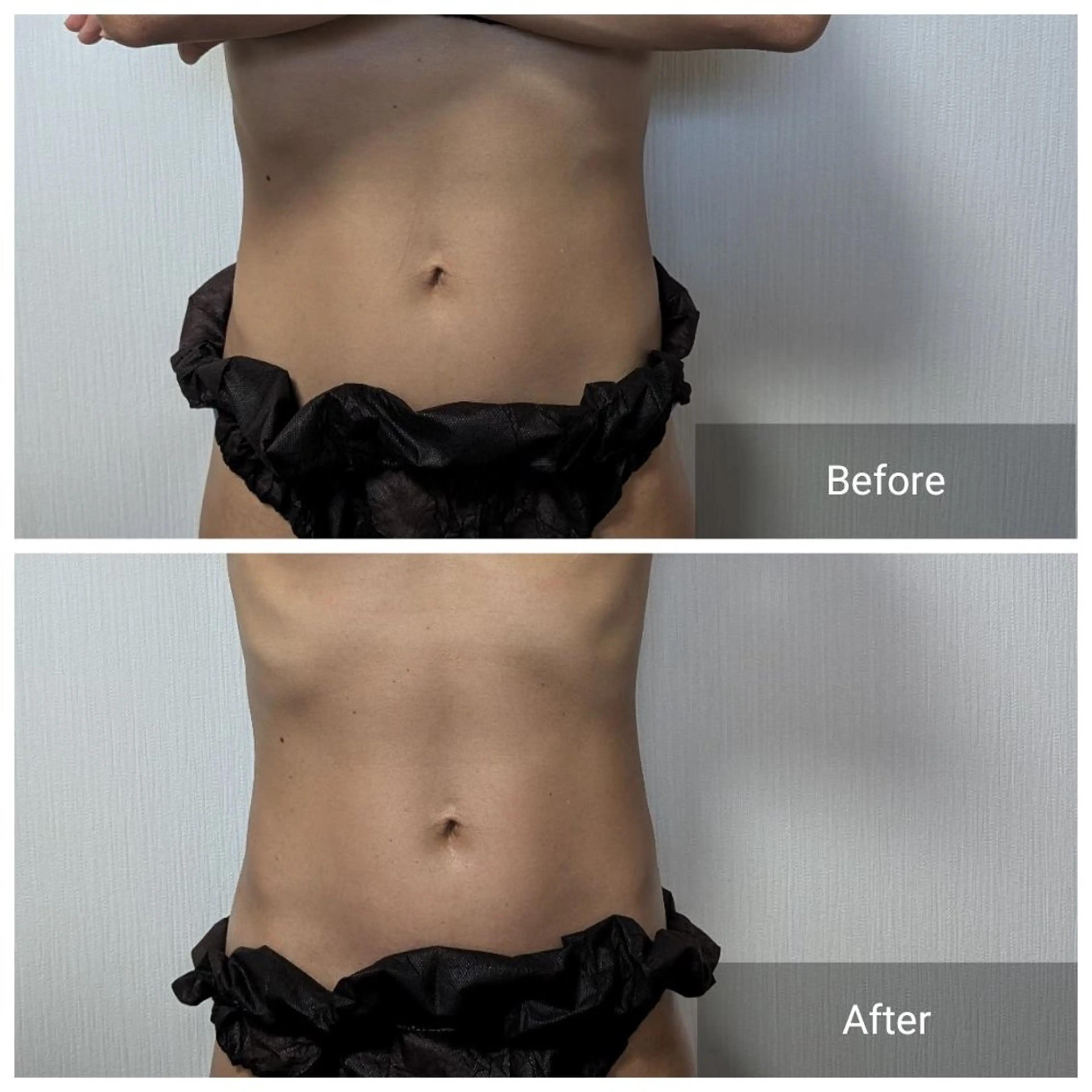 エステ nail RiRi アトレナチュラのエステ・リラクイメージ