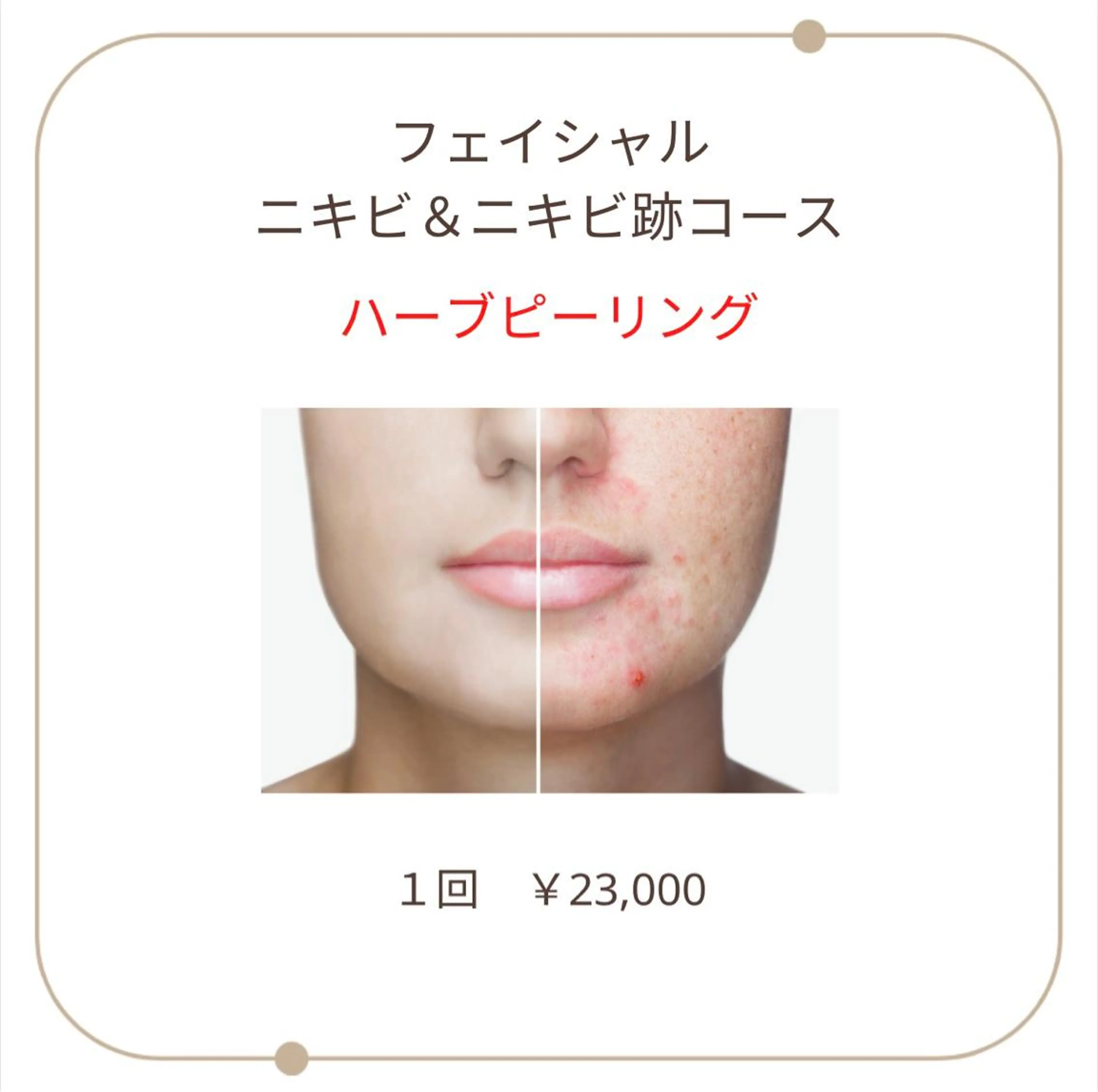 ベラージュ【美背中・ 美尻・フェイシャル】のエステ・リラクイメージ