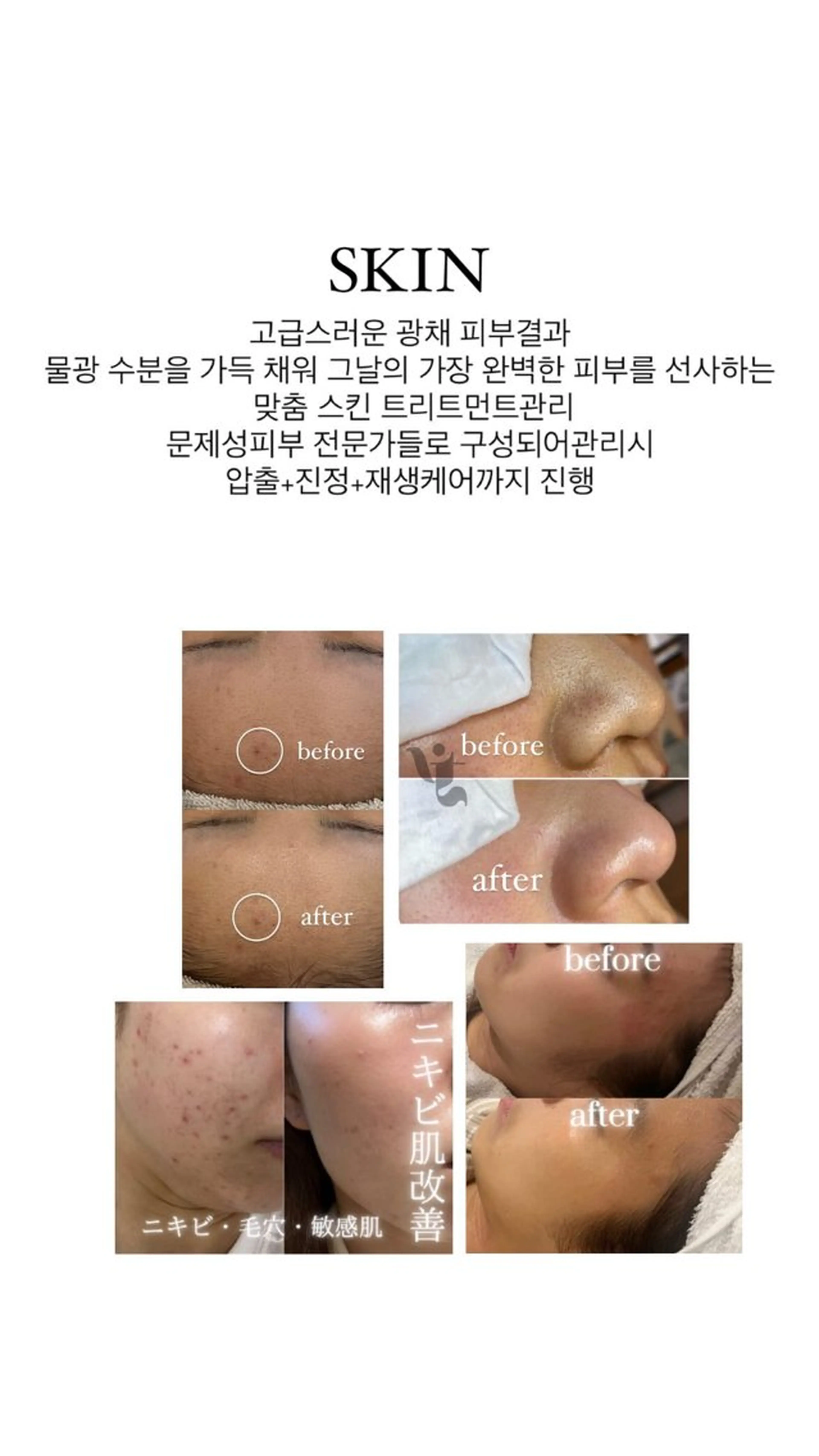 エステ リラク 【vidyto】ヴィディトゥ所属・肌管理サロン vidyto　MOEのエステ・リラクイメージ