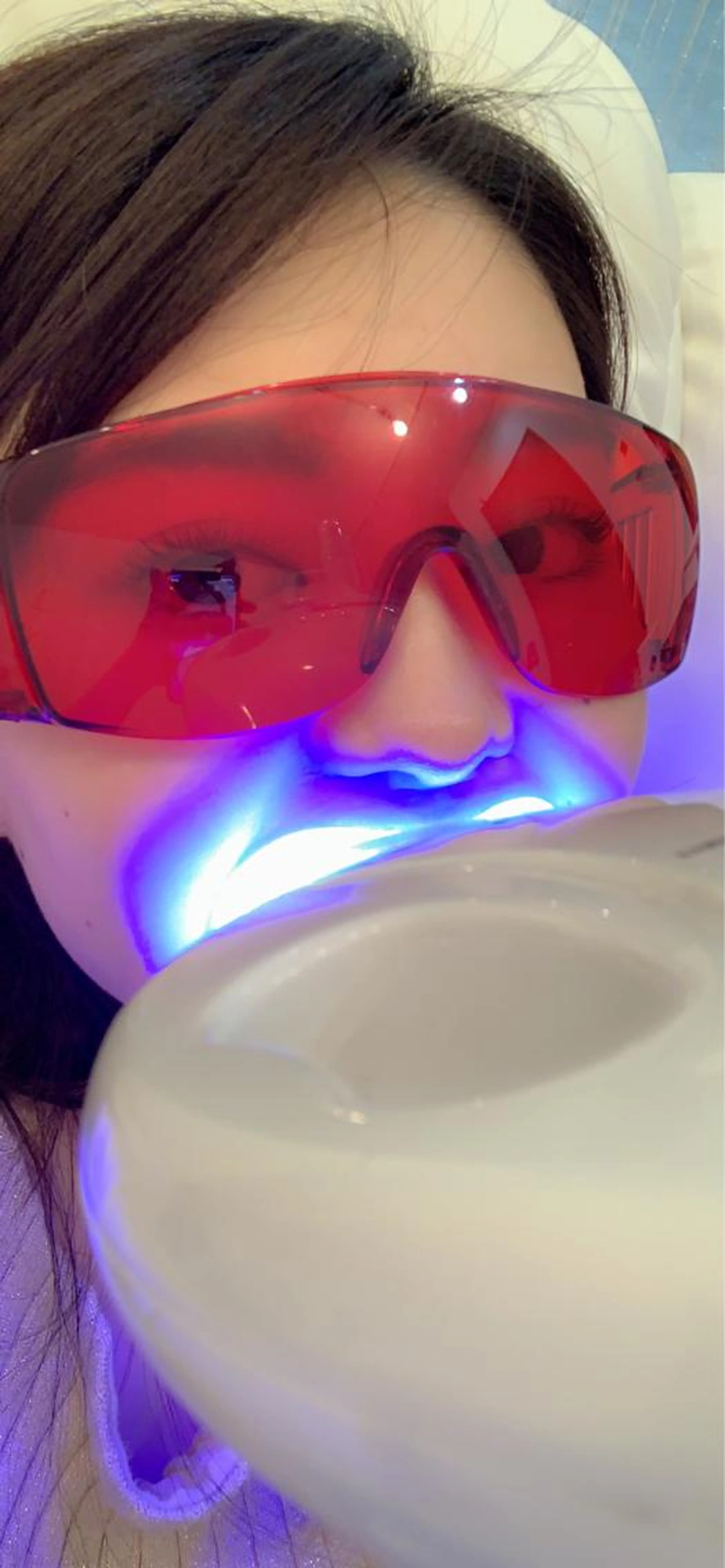 セルフホワイトニング🦷ご新規様¥7700→¥3980✨10分✖️2セットできてお得！！🚨折返しご連絡で予約確定の写真