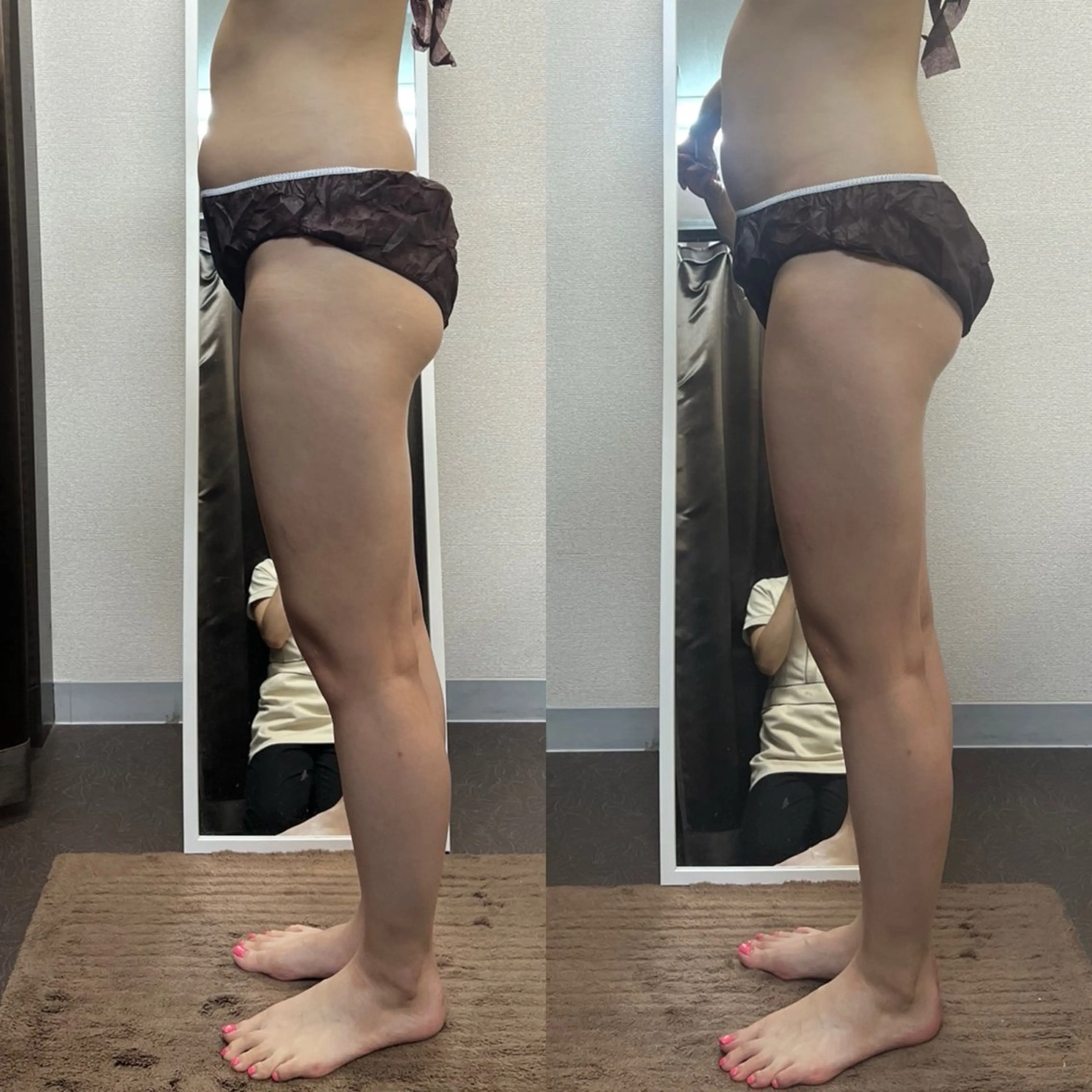 ハイパーナイフ専門店　Salon de COCO所属・Salon de COCOのエステ・リラクイメージ