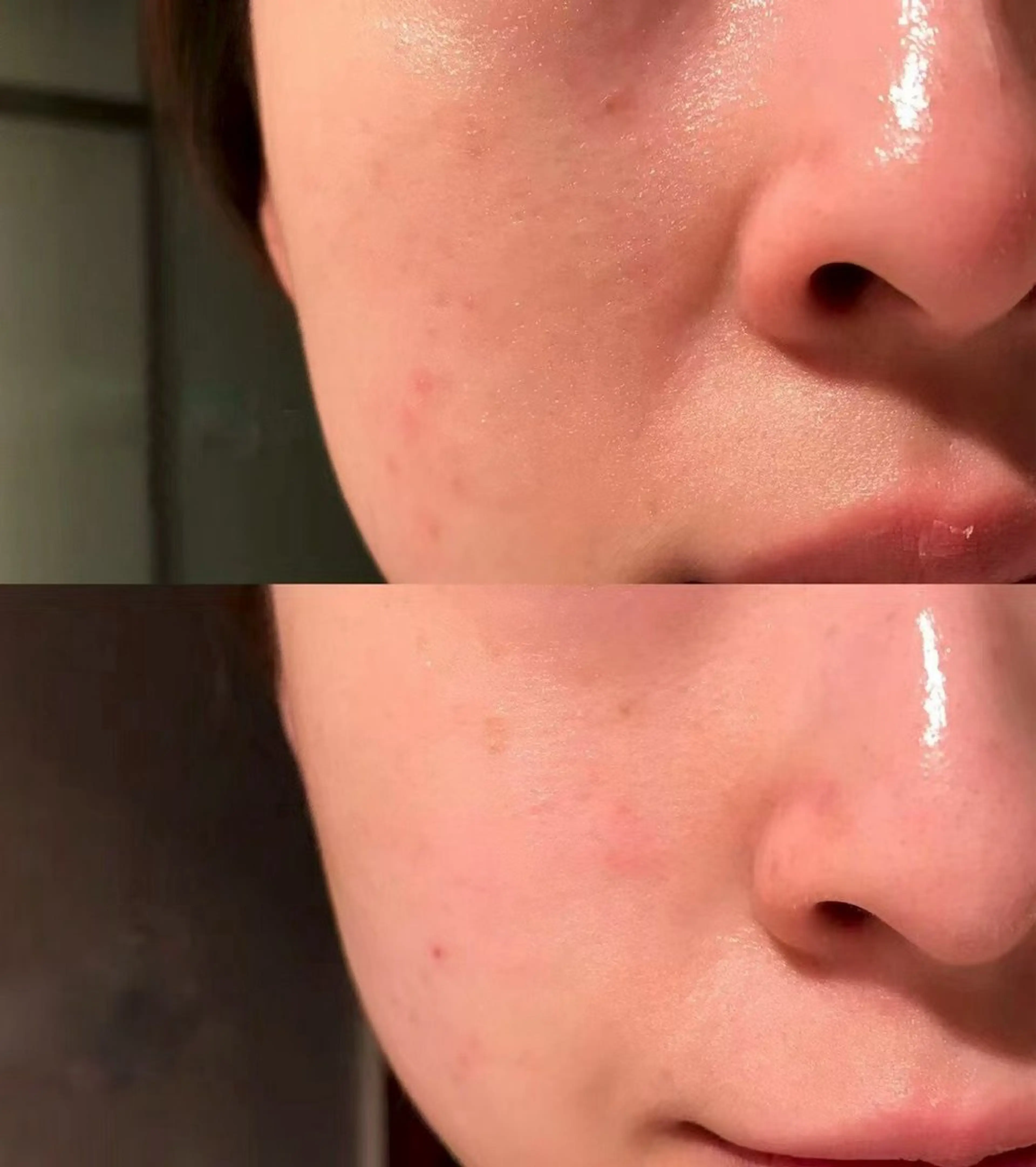 ネイル エステ aliaハイフ&水光ジェットサロン所属・aliaハーブ水光店 エステティシャン募集のエステ・リラクイメージ