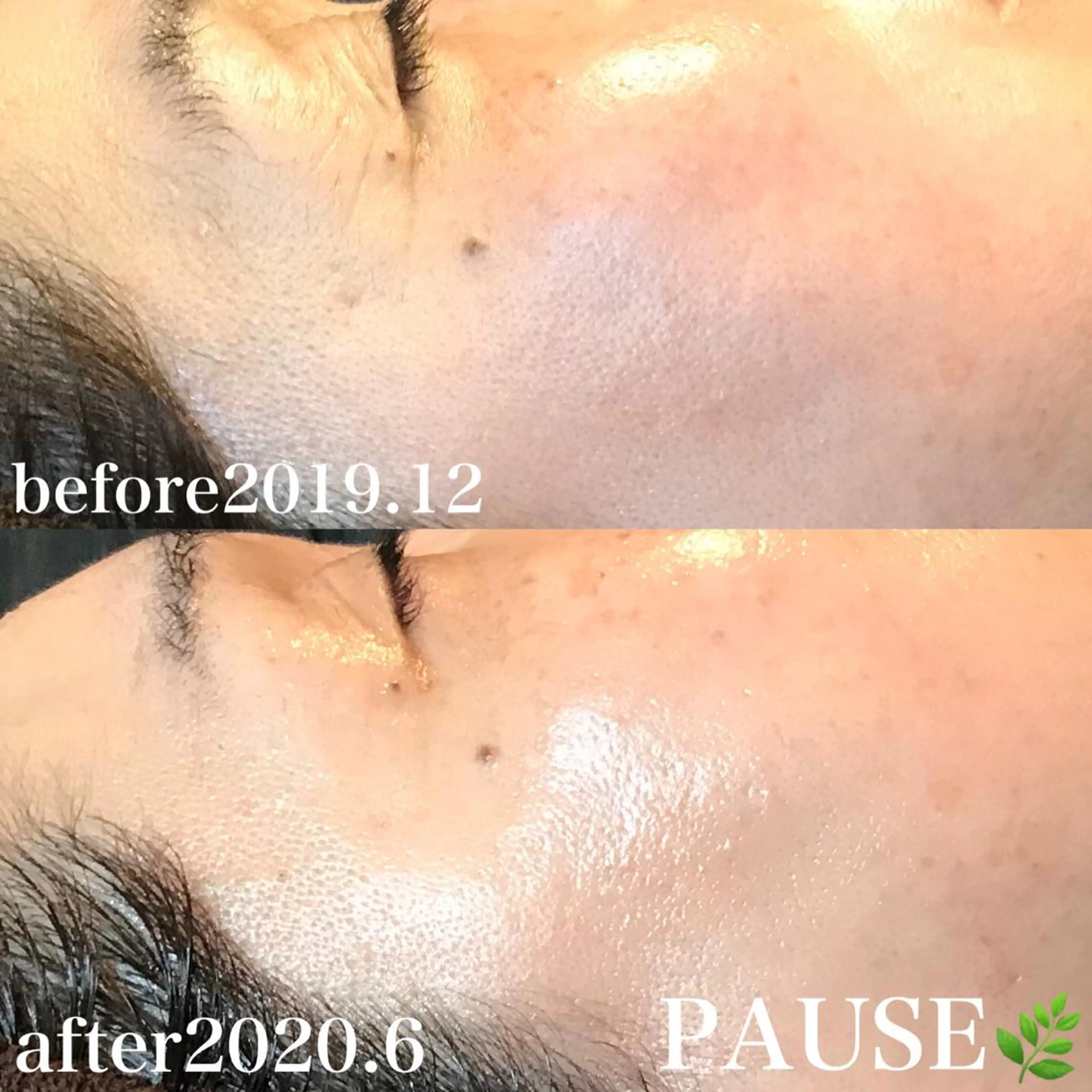 エステ 浜野 恵美のエステ・リラクイメージ