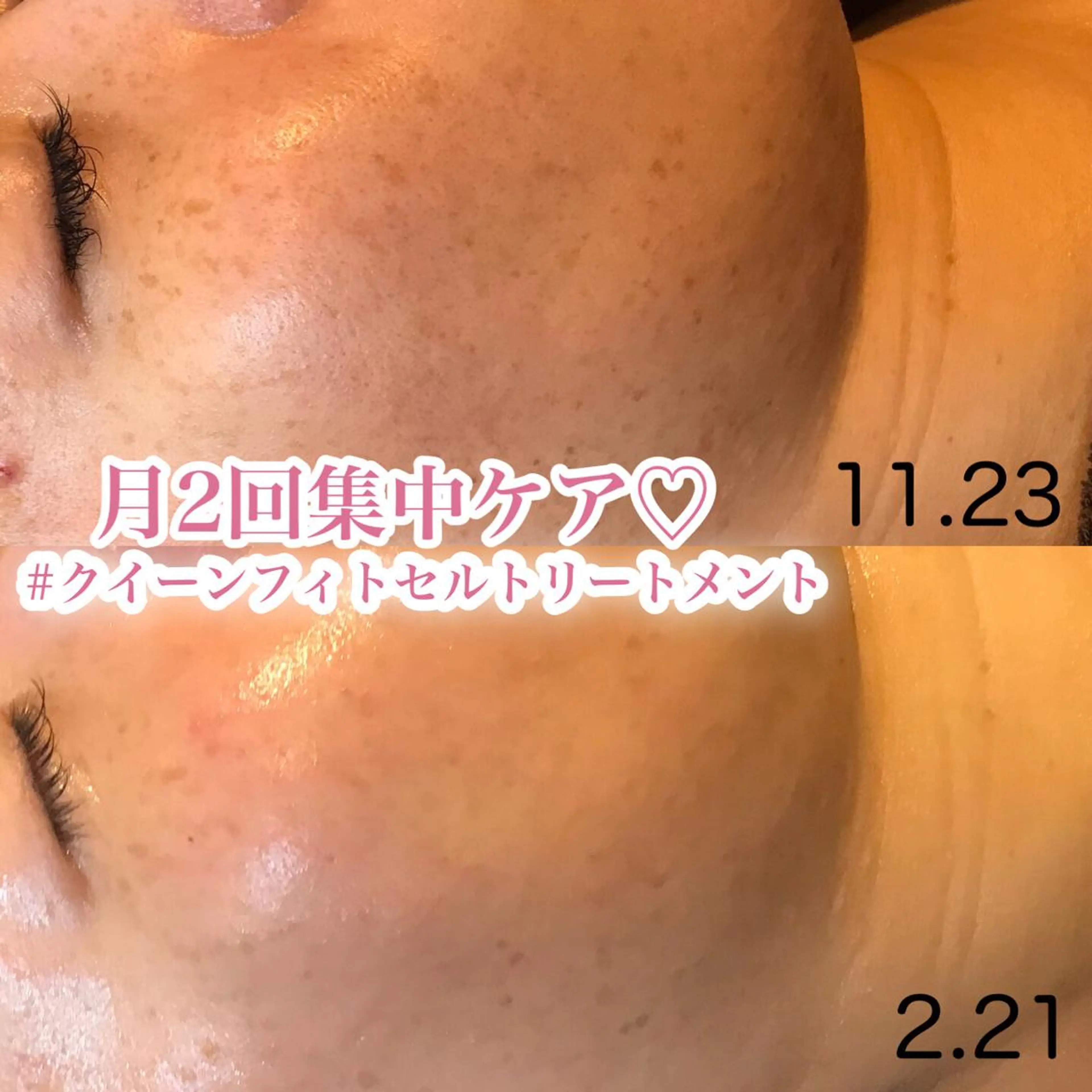 エステ 浜野 恵美のエステ・リラクイメージ