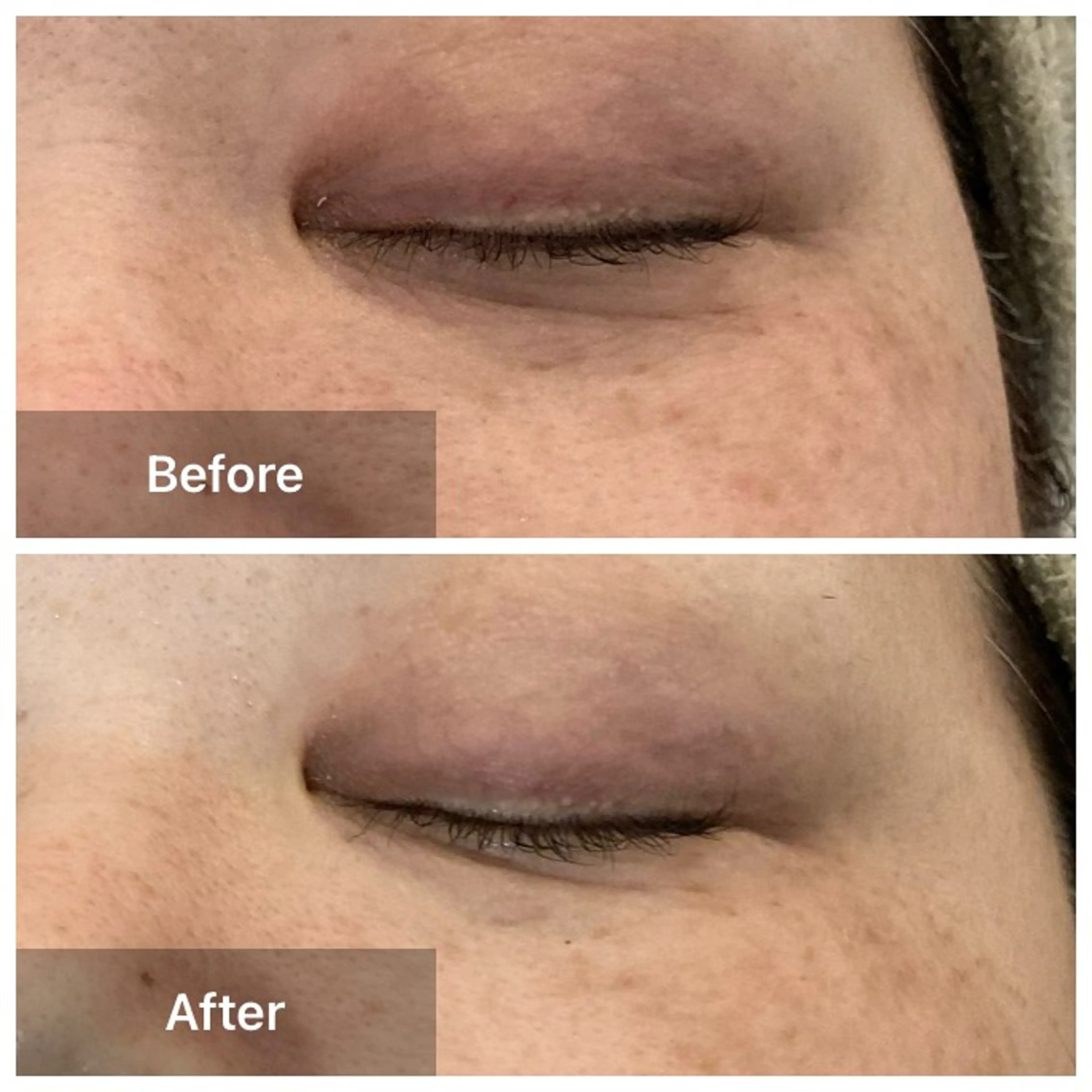 エステ リラク 目元・まつパ・美肌フ ェイシャル谷町四丁目のマツエク・マツパデザイン