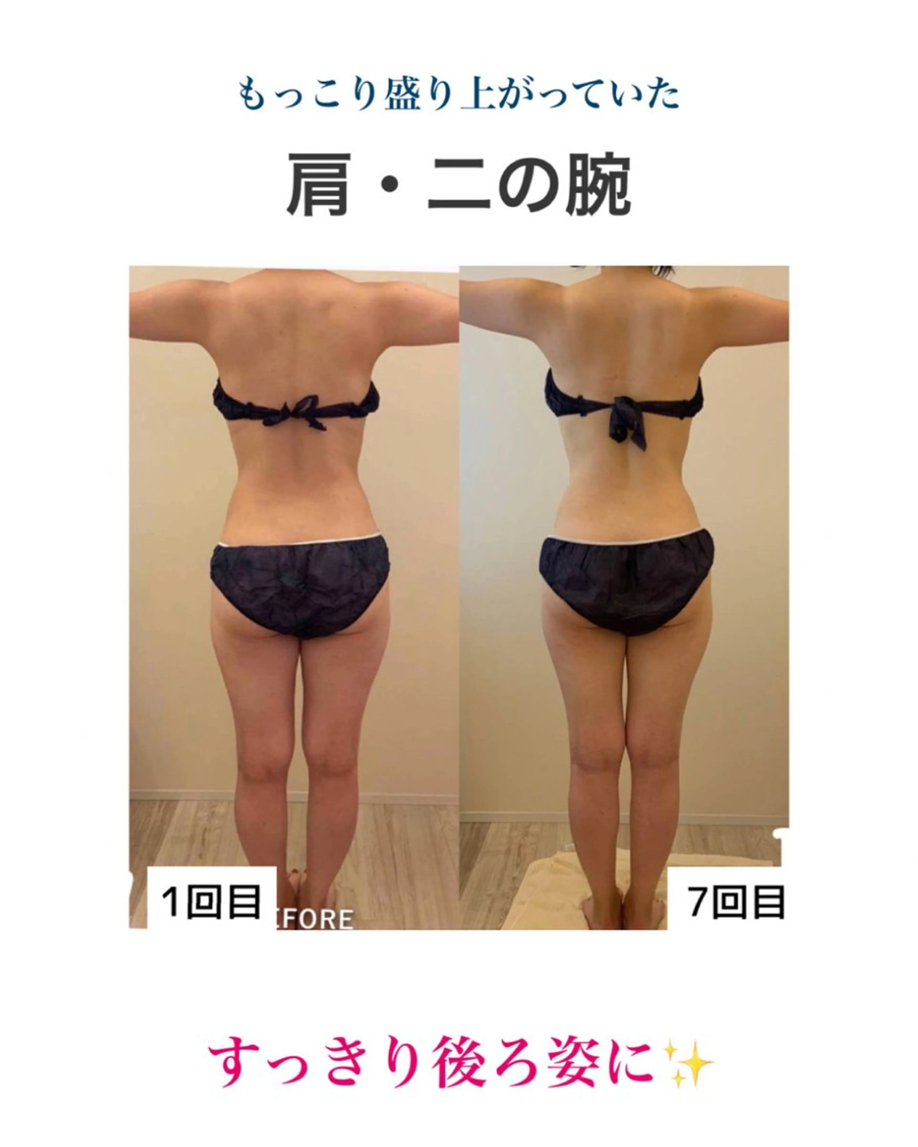 産後ダイエット−9㎏ Pourvous結衣のエステ・リラクイメージ