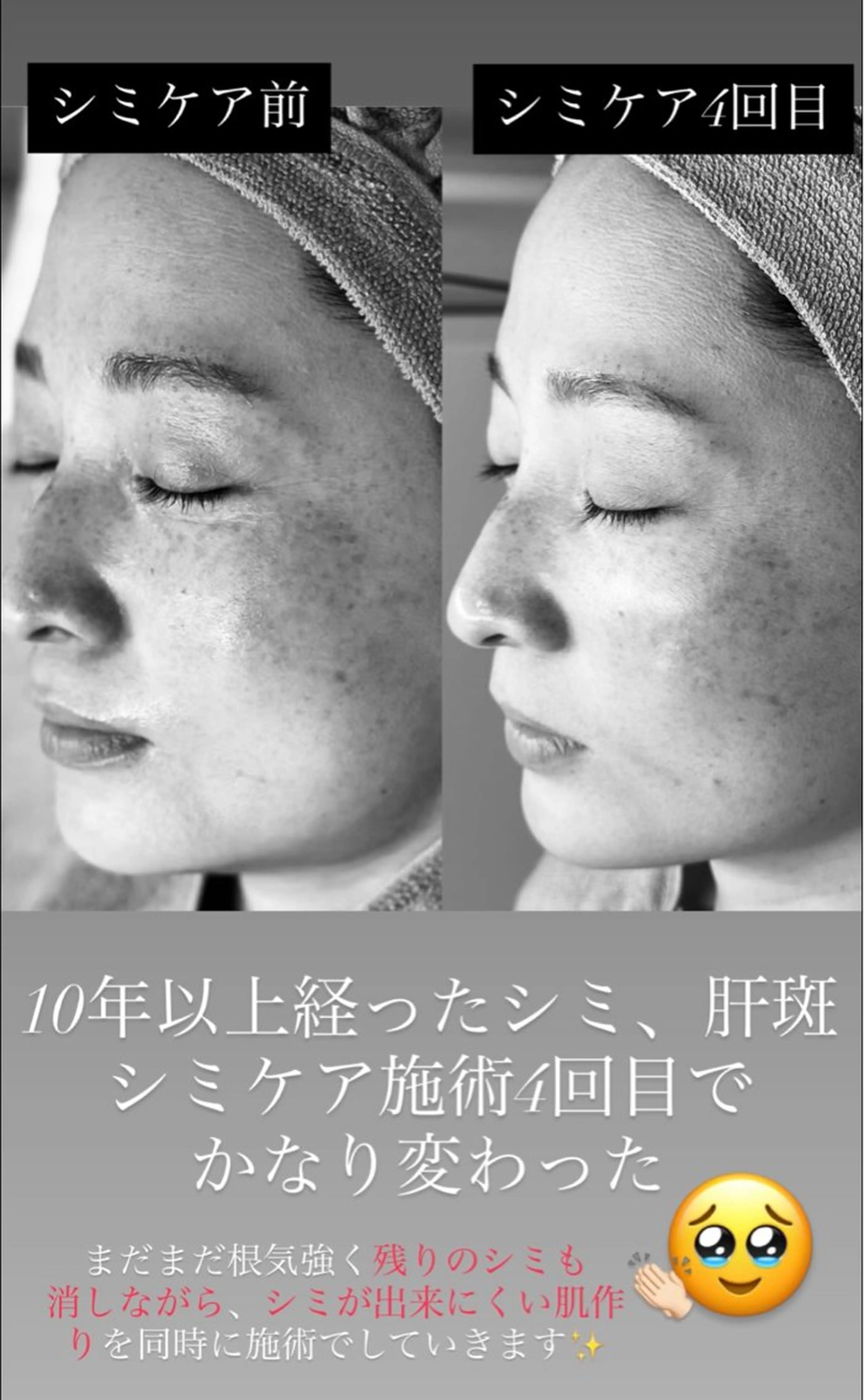 HINA/産毛脱毛・ 肌質改善専門サロンのエステ・リラクイメージ