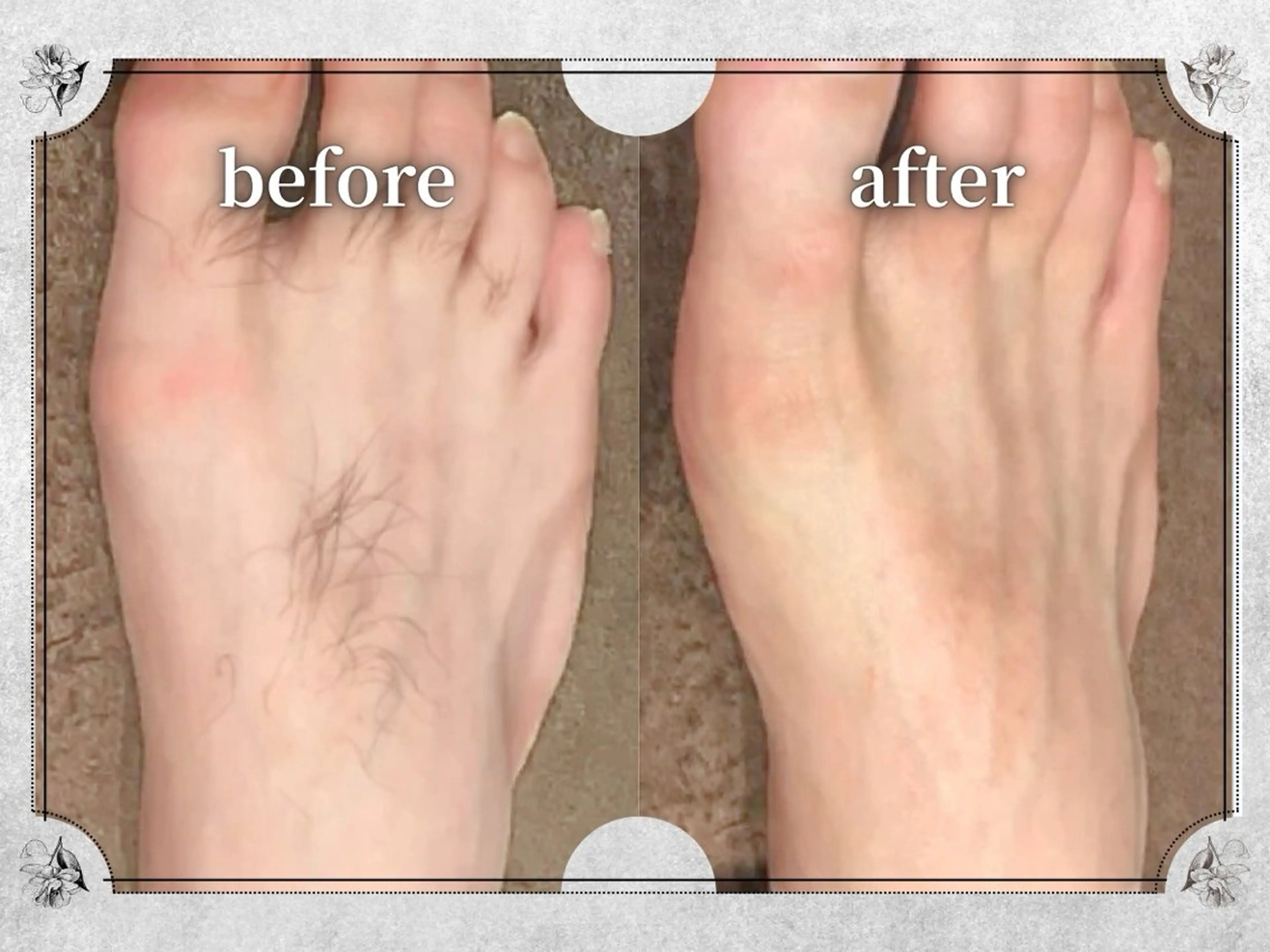 Lino by MIRA/Yuinaのエステ・リラクイメージ