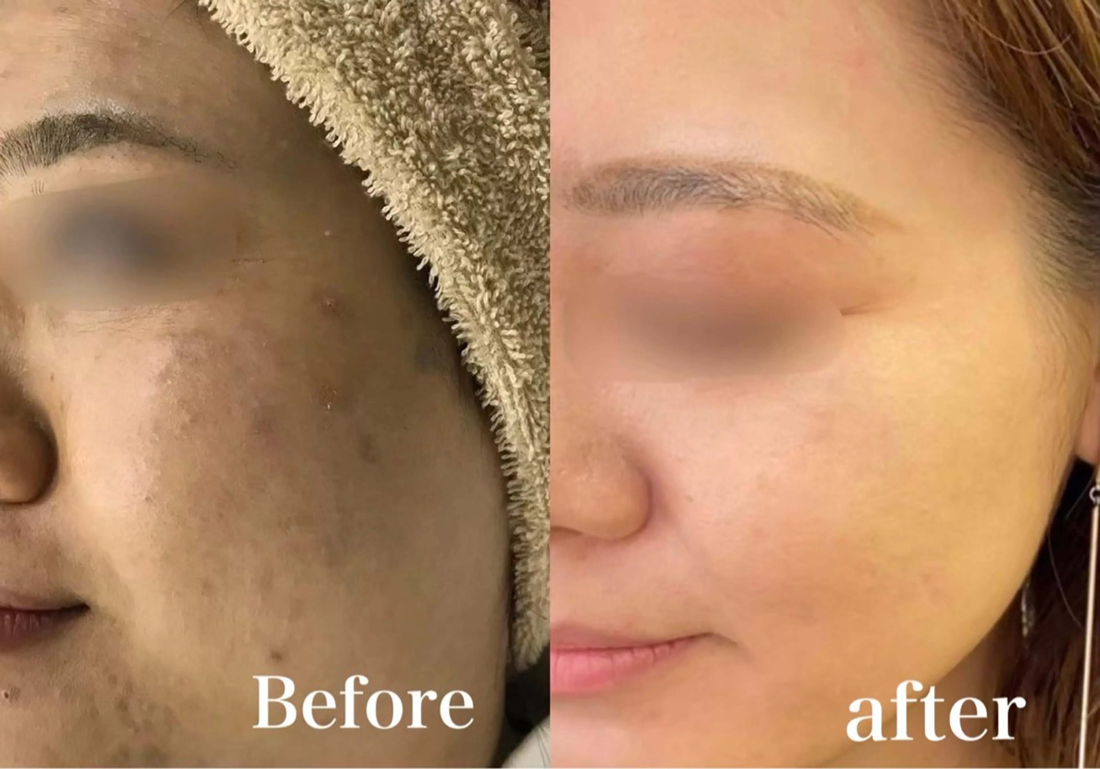 OOPARTS所属・大塚 杏美のエステ・リラクイメージ