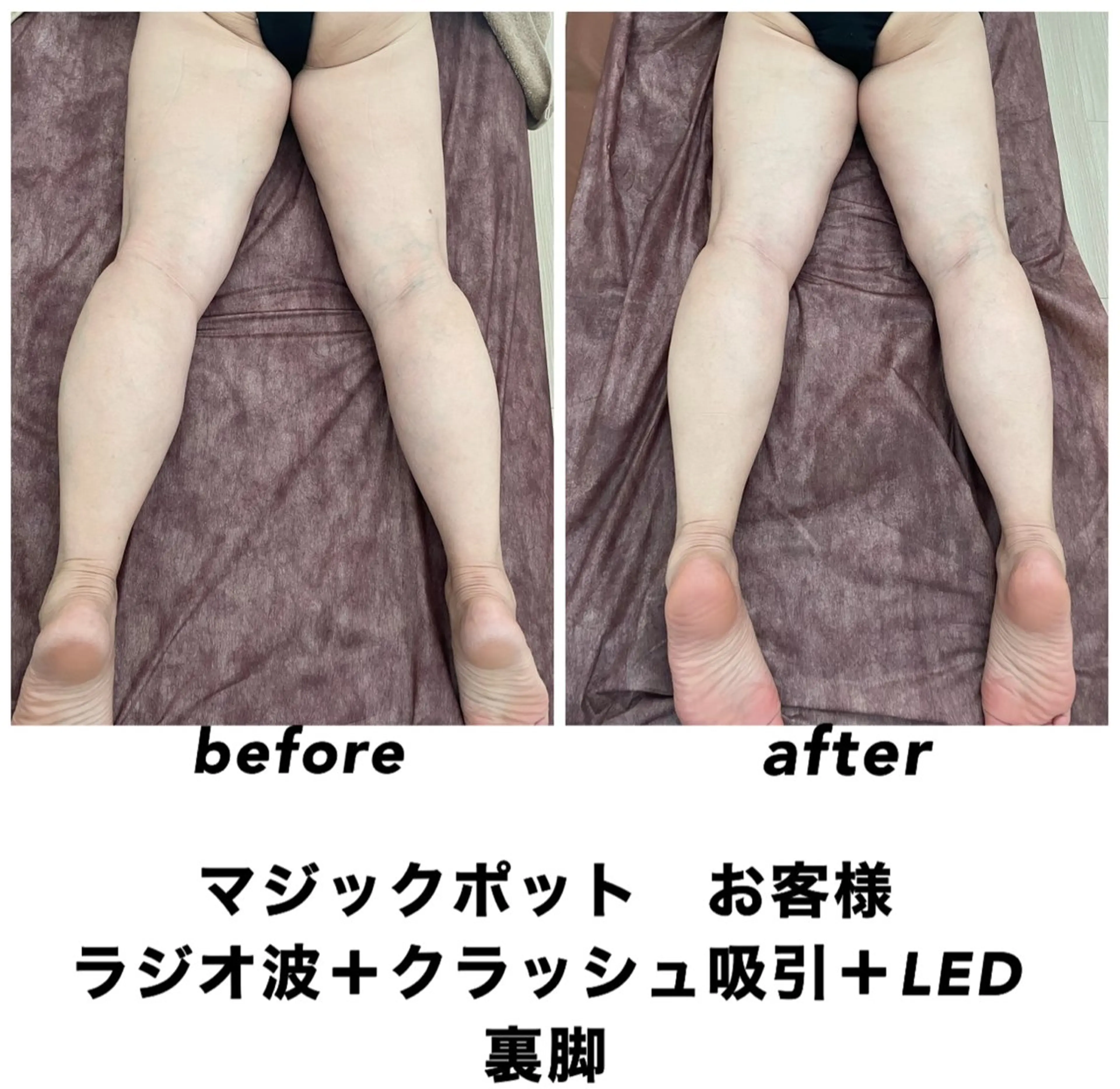 エステ リラク ネイル・エステサロンUILANI所属・ネイル・エステサロン UILANIのネイルデザイン