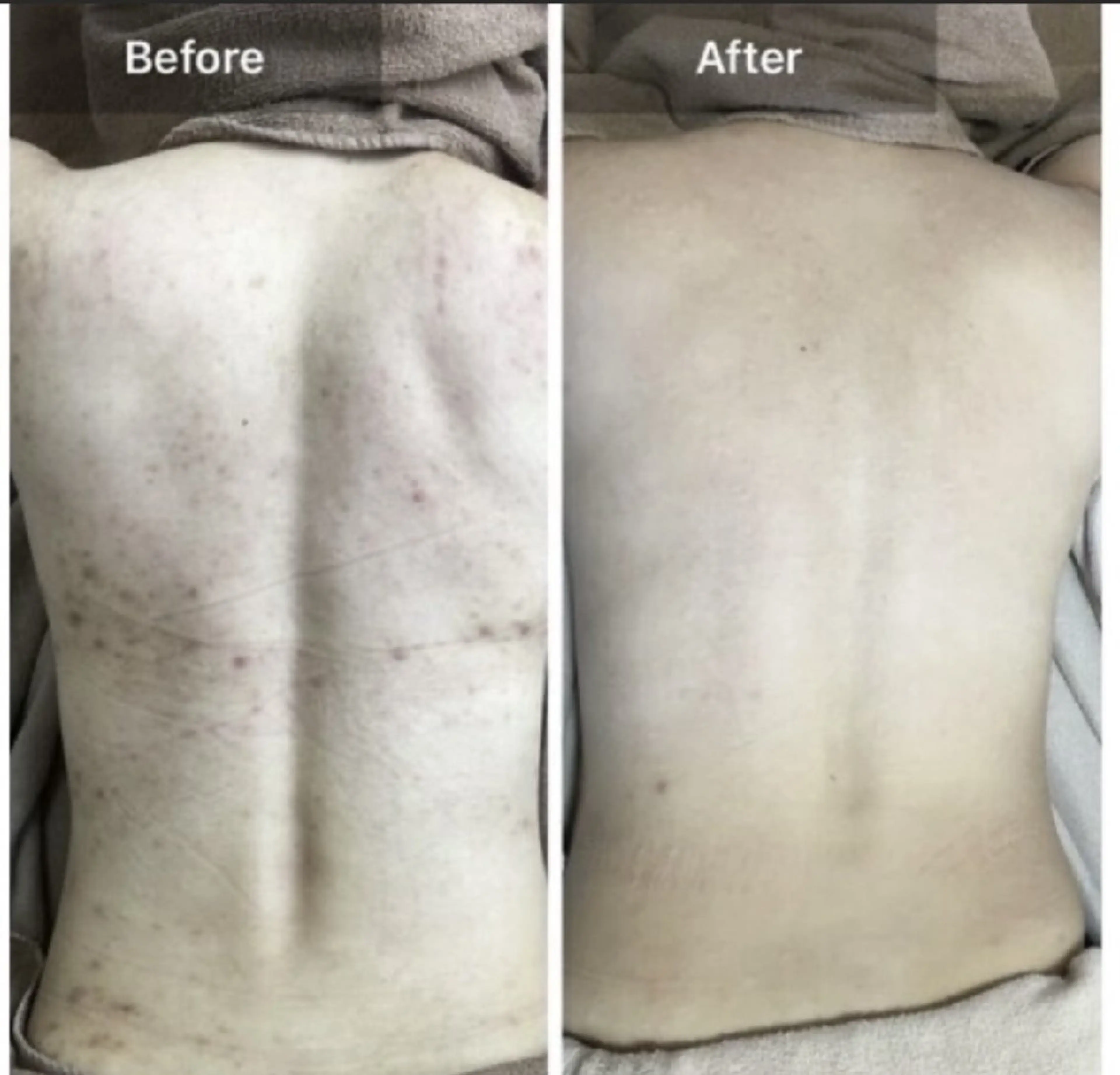 エステ ハーブピーリング専門 COCO.梅田中津のエステ・リラクイメージ