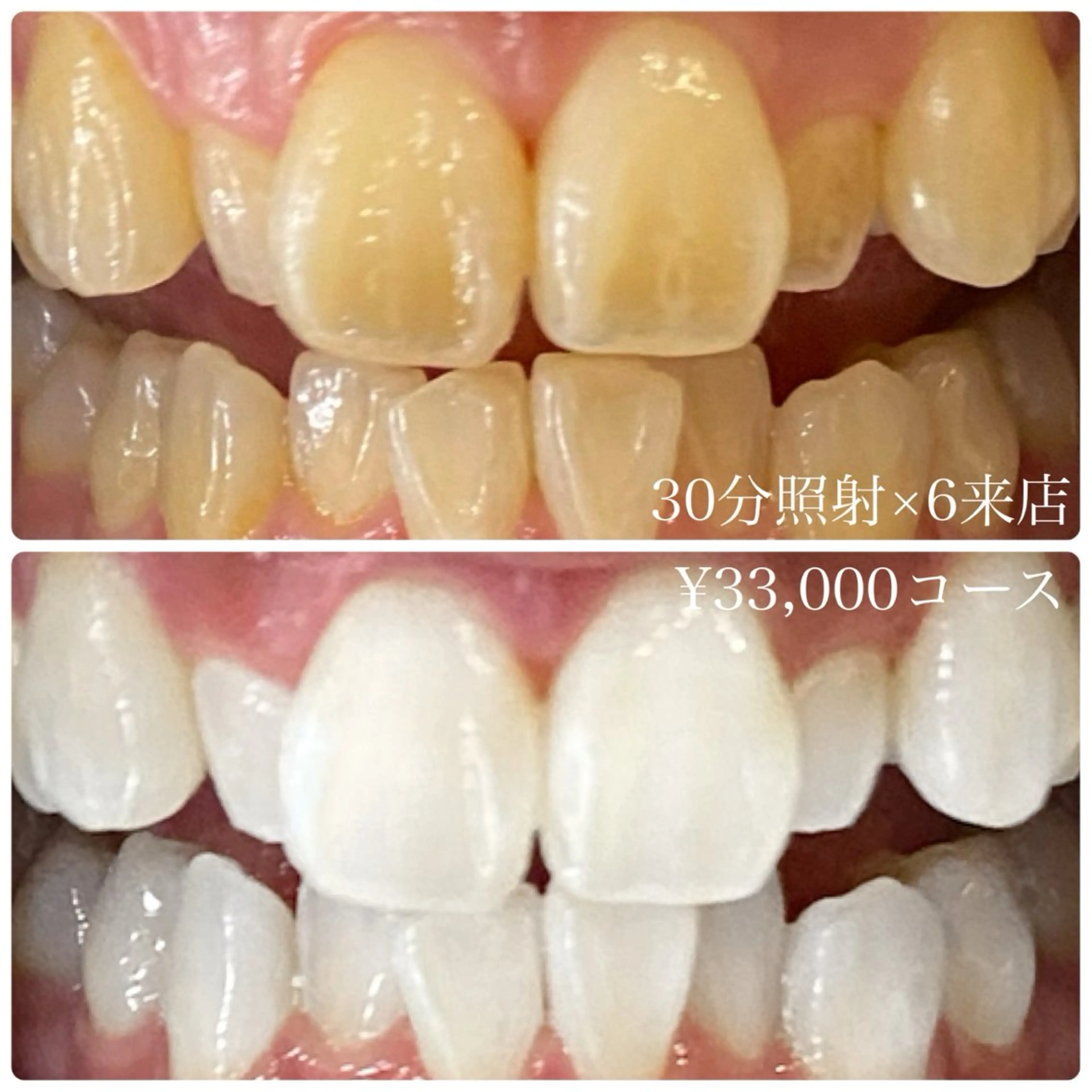 メンズ その他 ホワイトニングルーム　川崎店所属・ホワイトニング ルーム　川崎店のその他イメージ