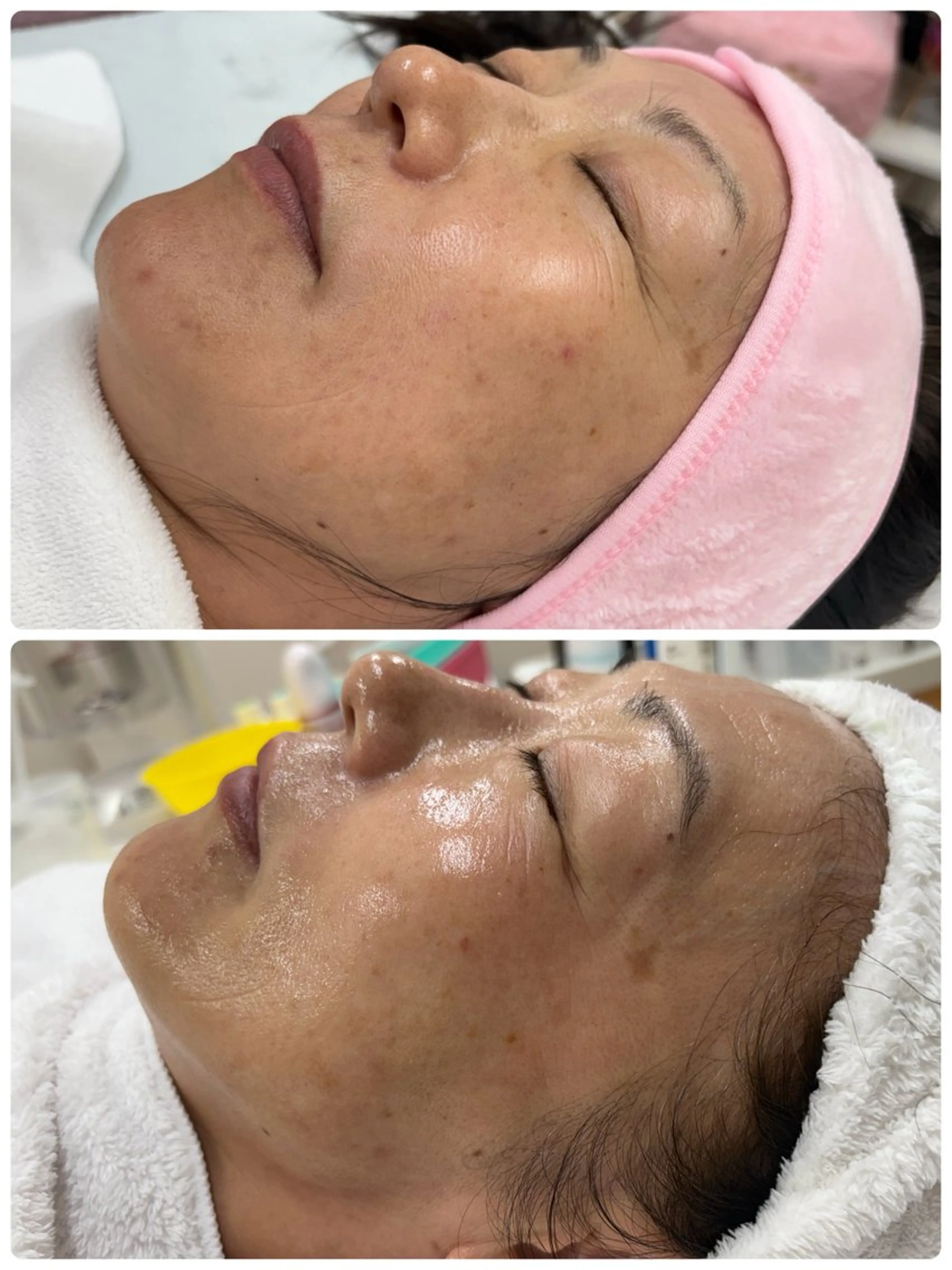 エステ フェイシャルサロン クリスタのエステ・リラクイメージ