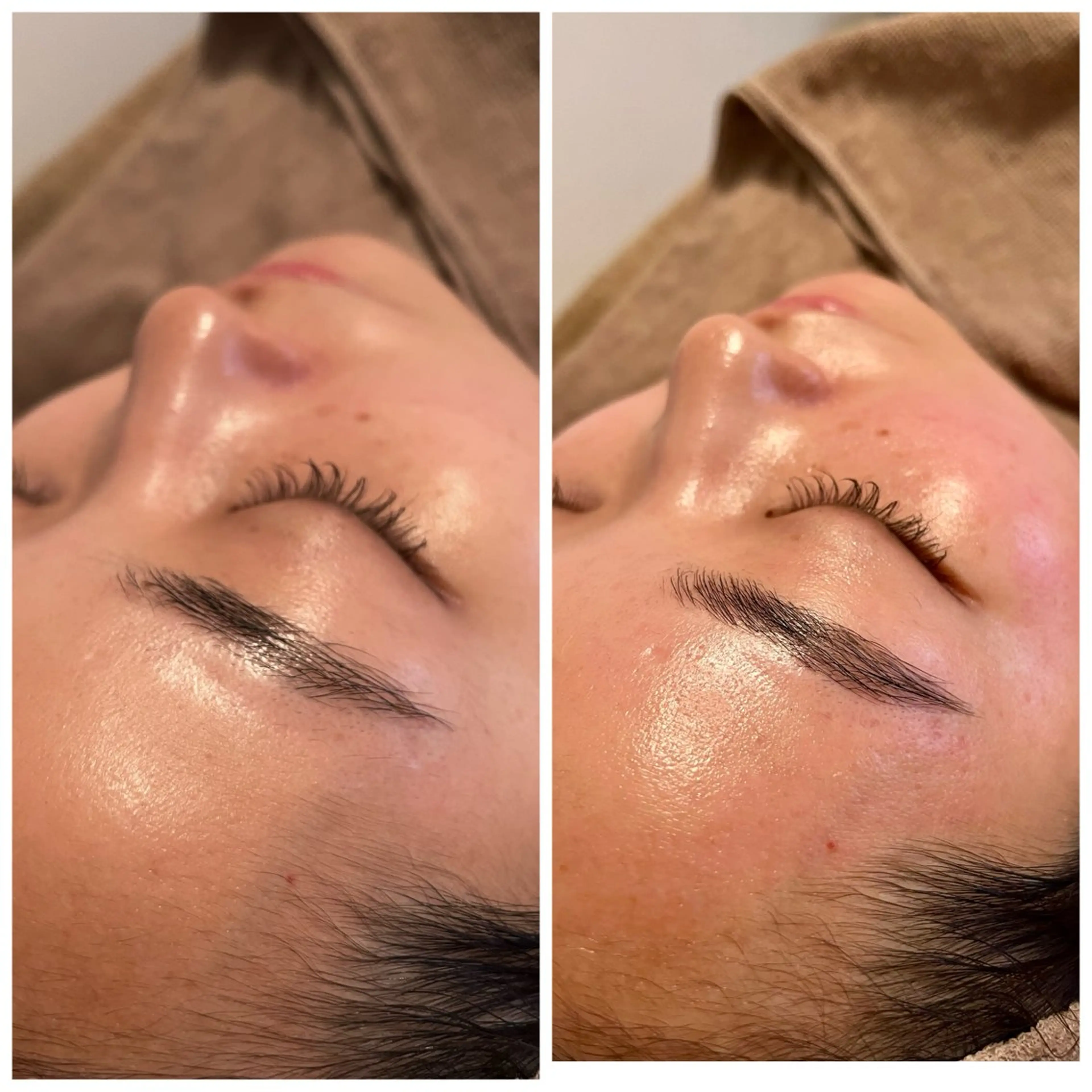 B&H所属・頭痛•肩こり専門/ 眉サロンB&H心斎橋のエステ・リラクイメージ