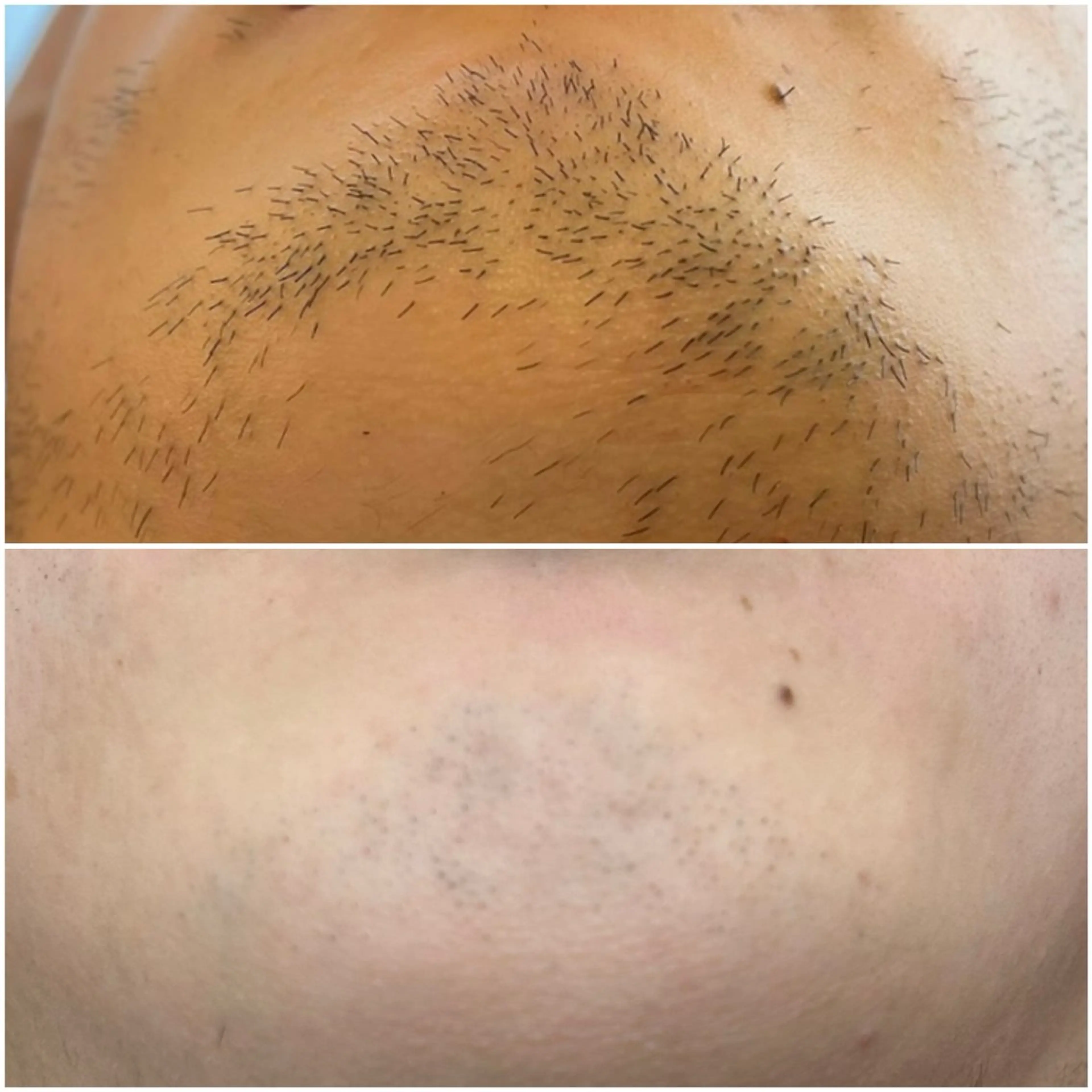 メンズ エステサロンMee. 大畑のエステ・リラクイメージ