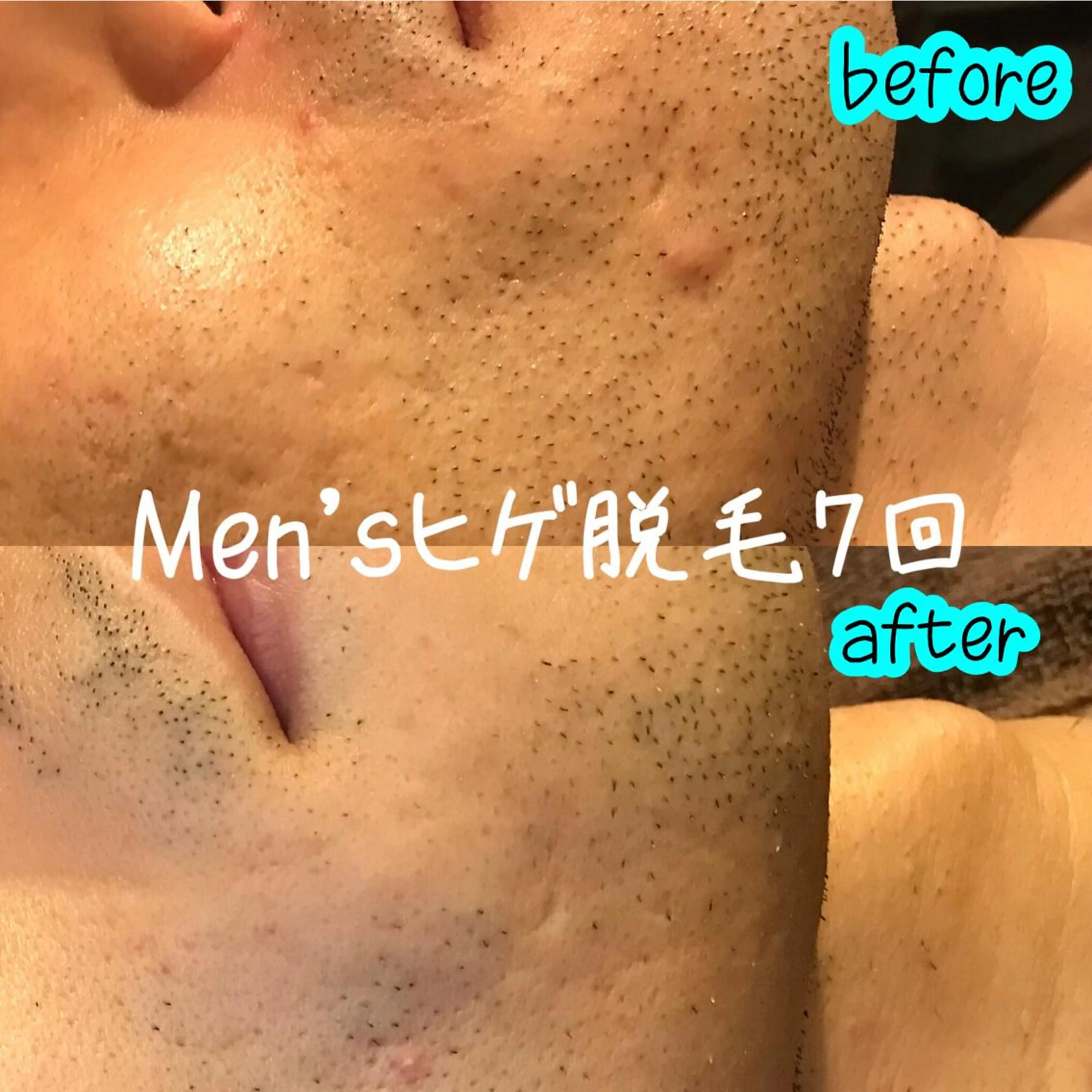 脱毛 浜野 恵美のエステ・リラクイメージ