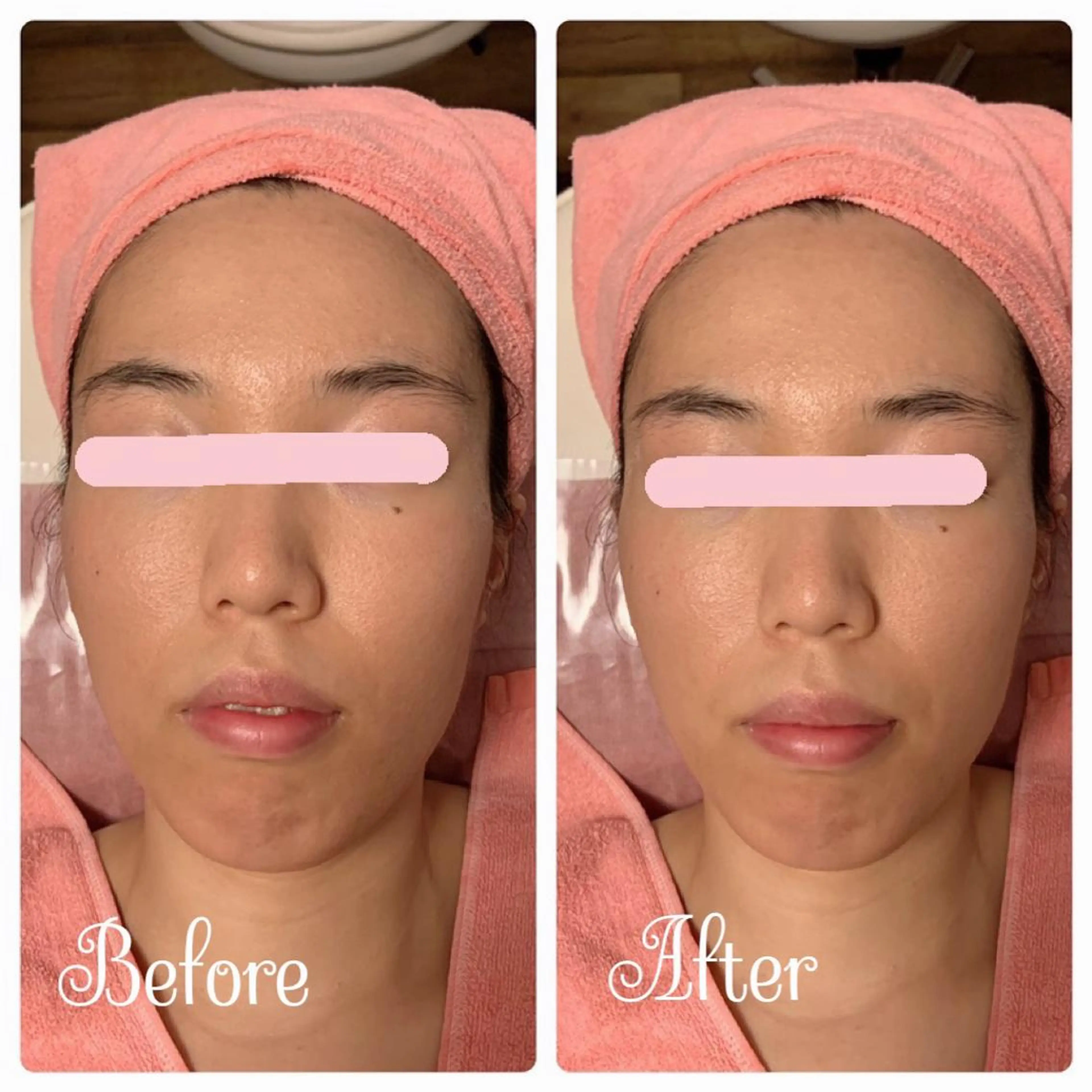 透明感の肌Lino malieのエステ・リラクイメージ