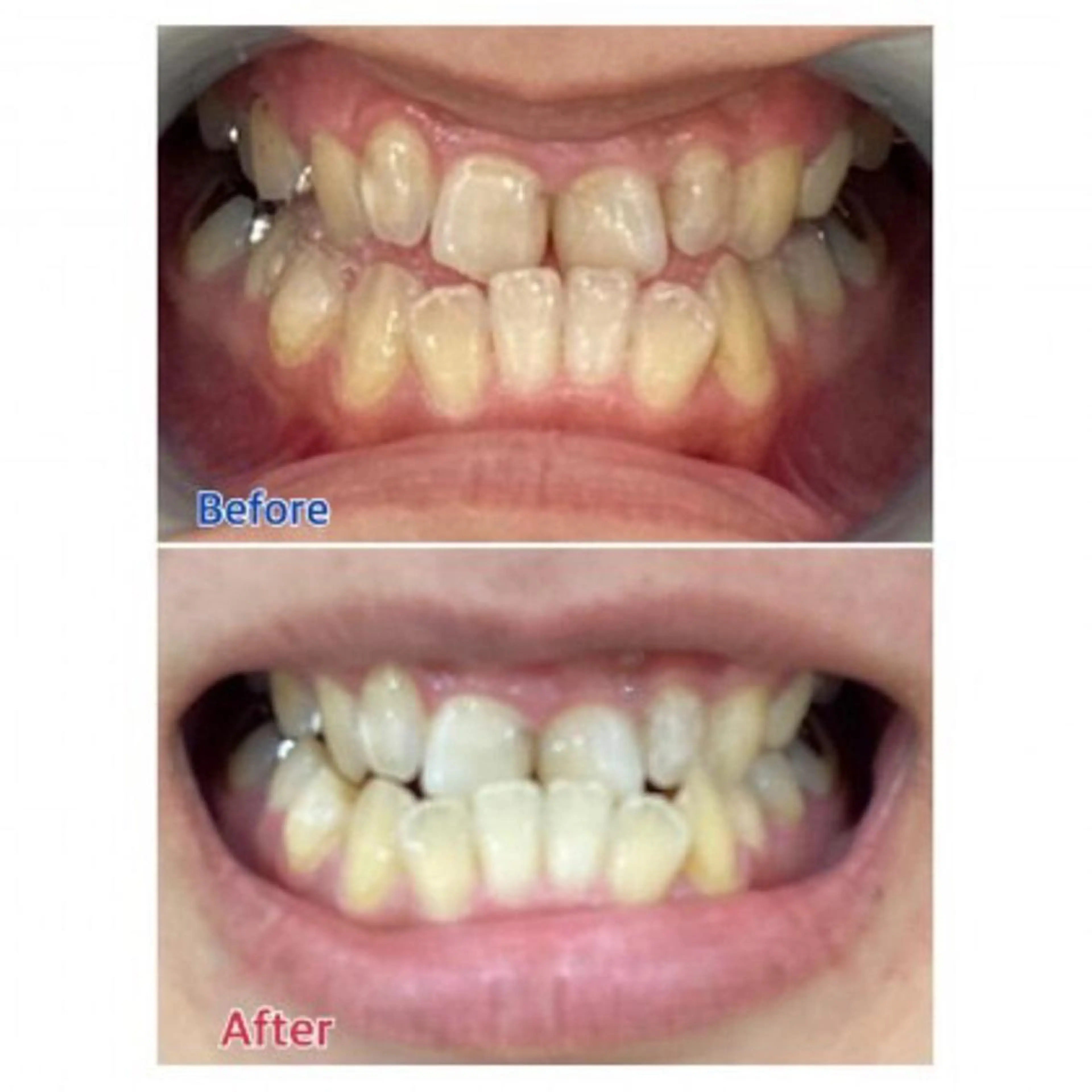 M渋谷店所属・Ｍ渋谷 ホワイトニングのエステ・リラクイメージ