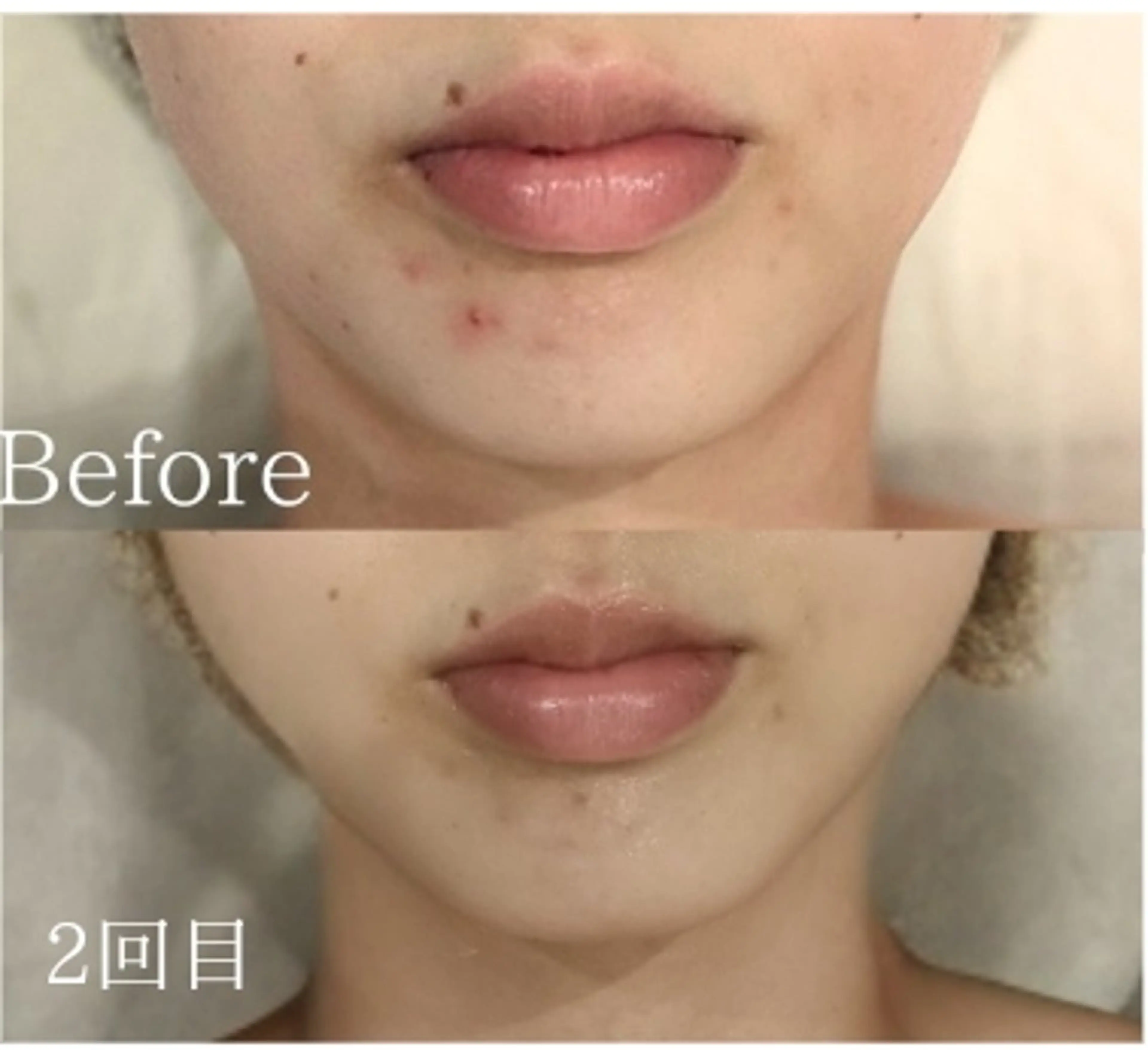 美肌脱毛＆小顔・フェ イシャル【SONA】のエステ・リラクイメージ