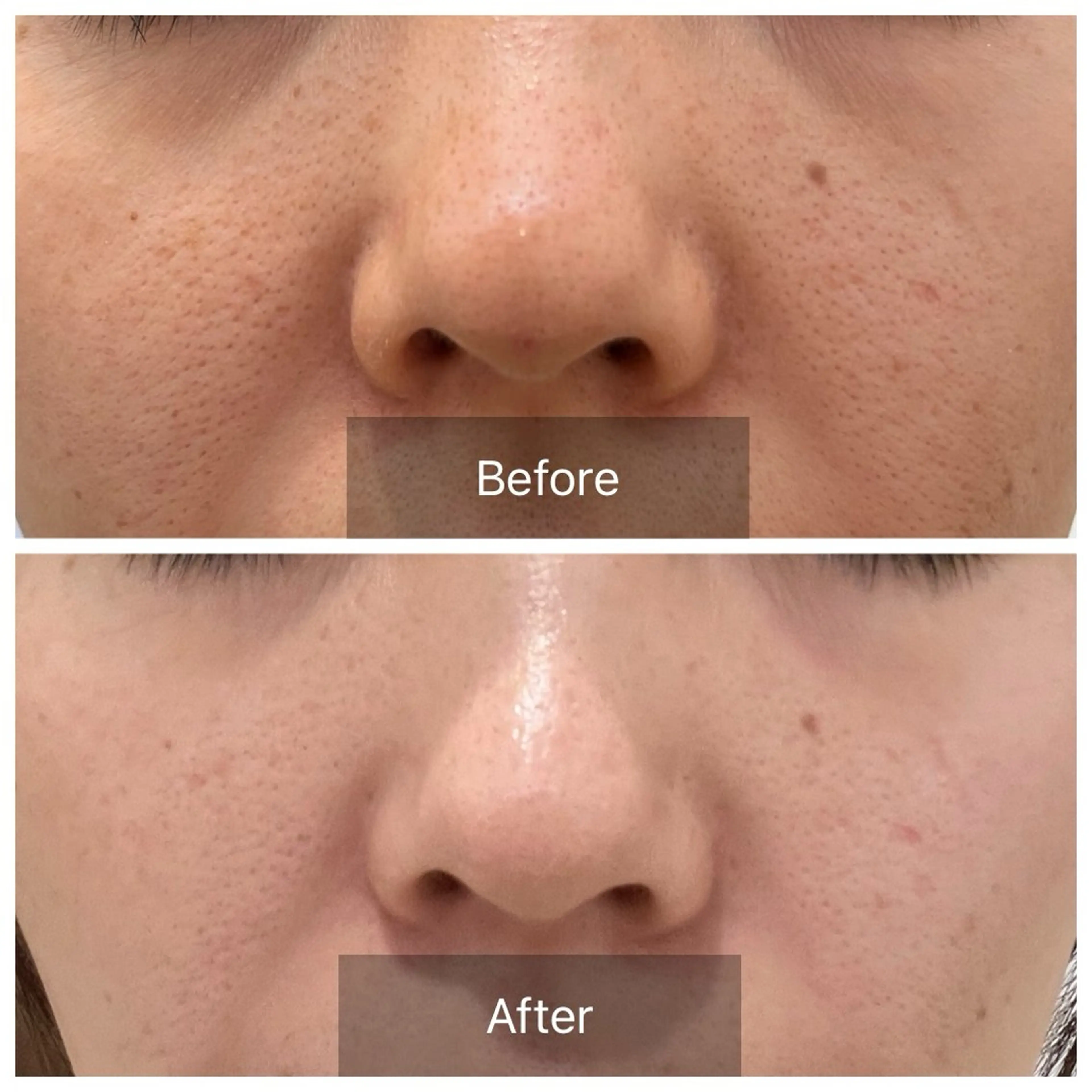 毛穴が見えなくなるサロン  Horo所属・岡 えり子のエステ・リラクイメージ