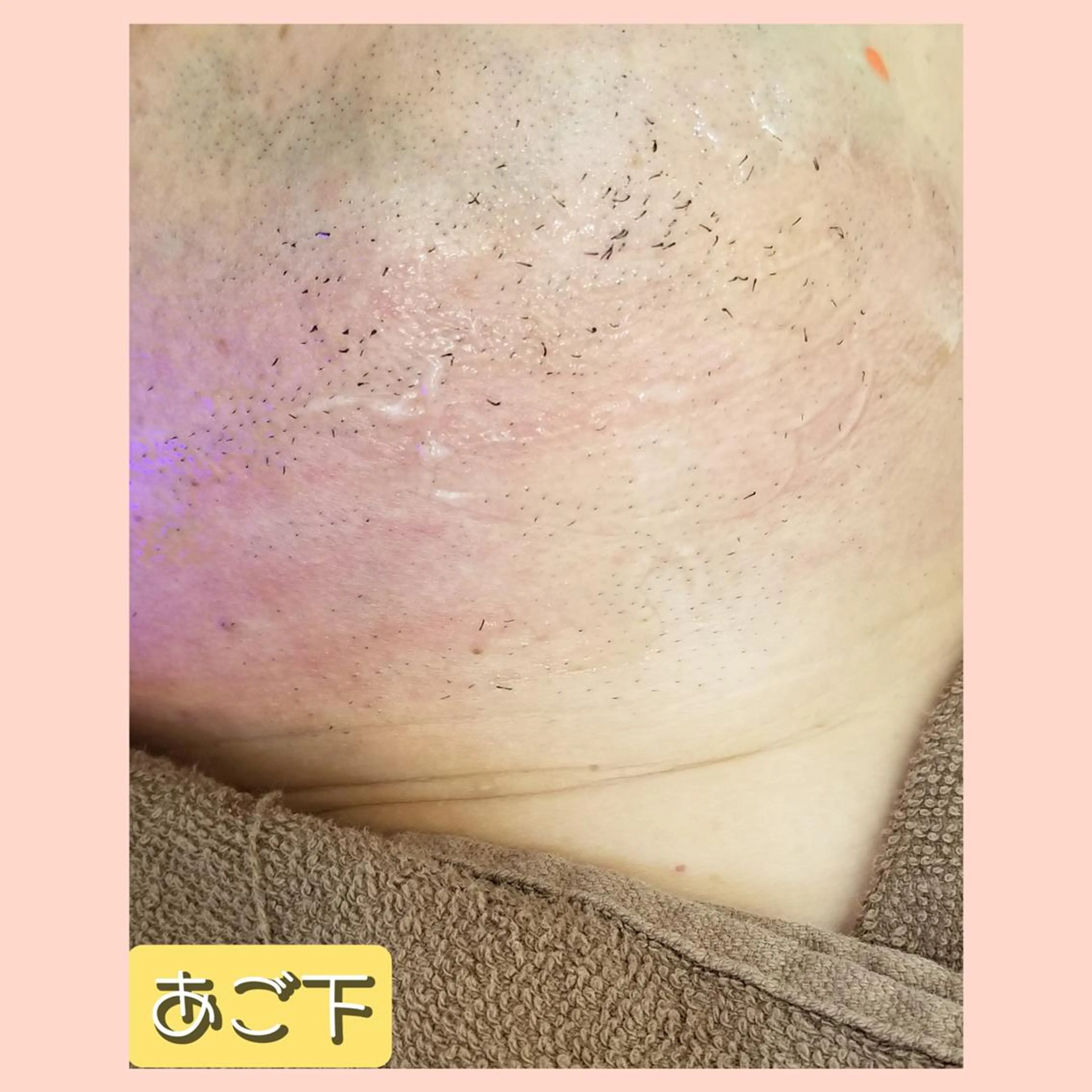 脱毛 salonde ReGodのエステ・リラクイメージ