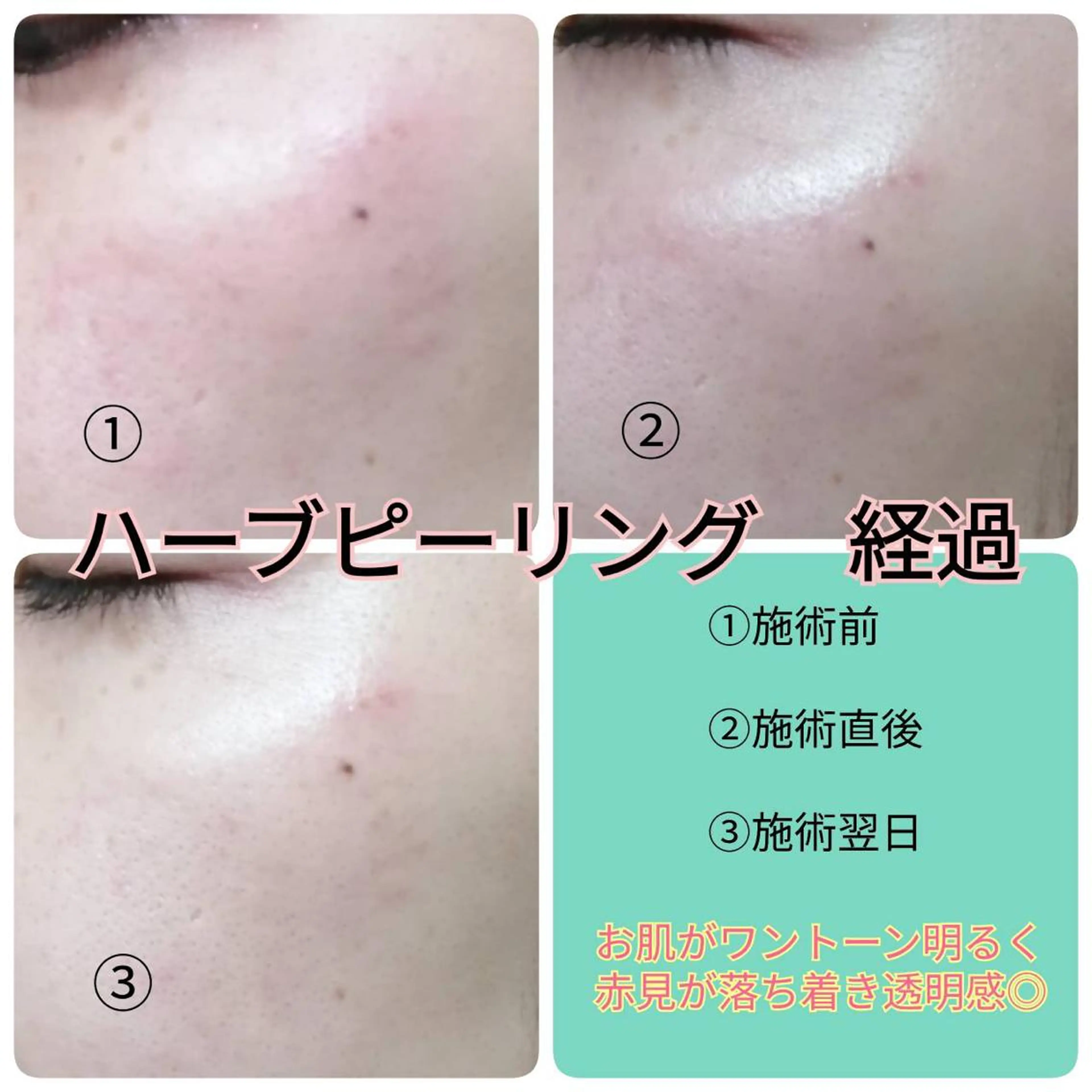 未病ケアサロン　EMINY所属・未病ケアサロン EMINY☺︎勝俣のエステ・リラクイメージ