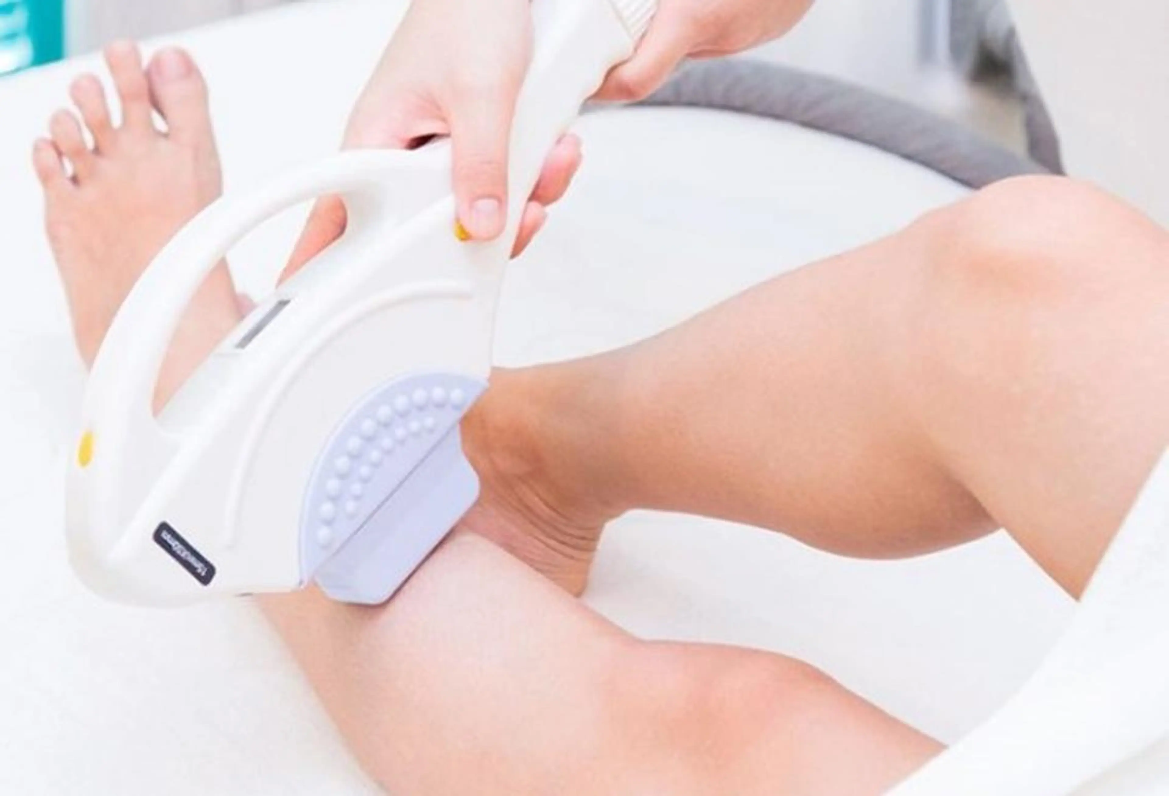 【メンズ・足全体】《口コミ特典》美肌脱毛 (ひざ・膝上・膝下・足の甲・指)の写真