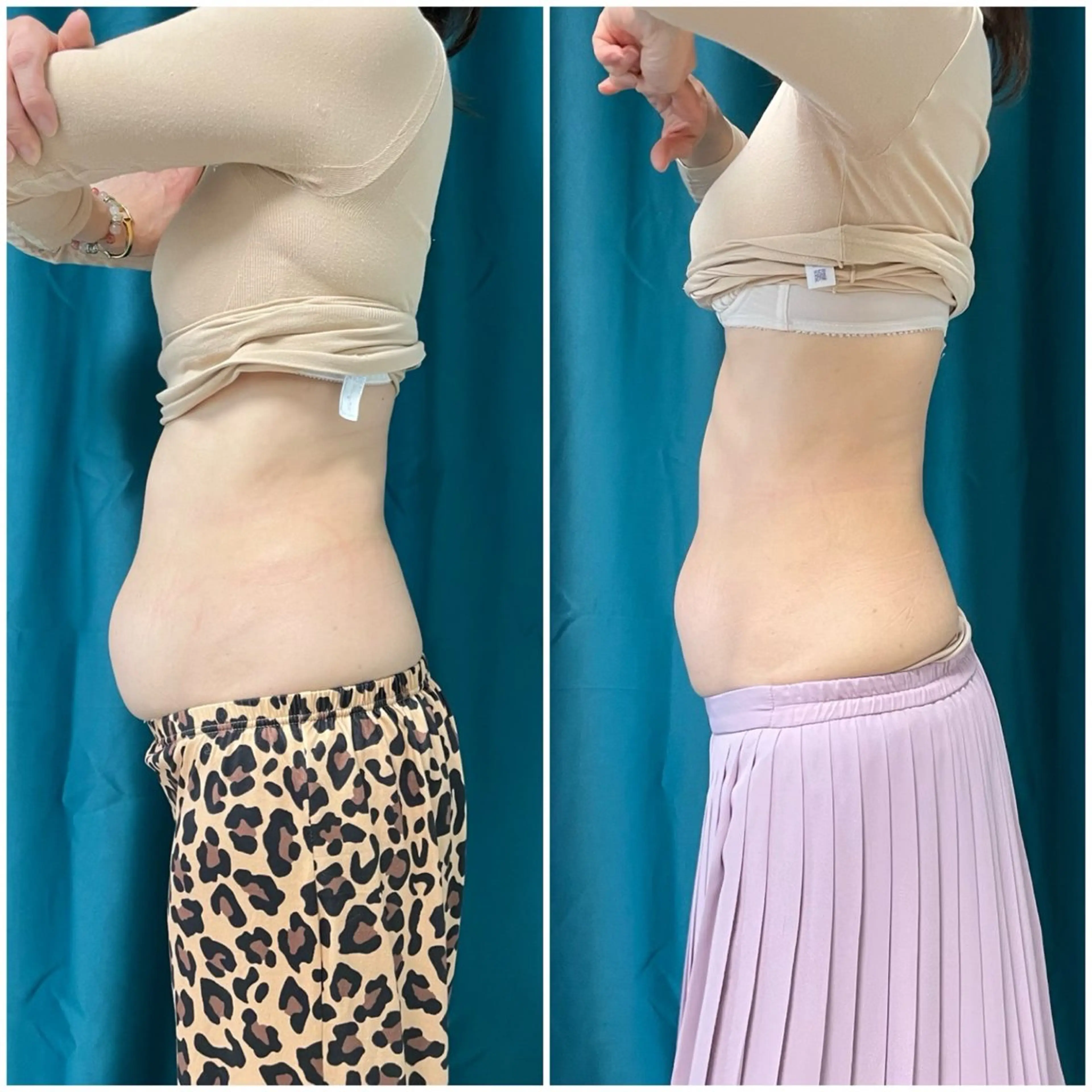 小顔矯正専門店 【RED】池田のエステ・リラクイメージ