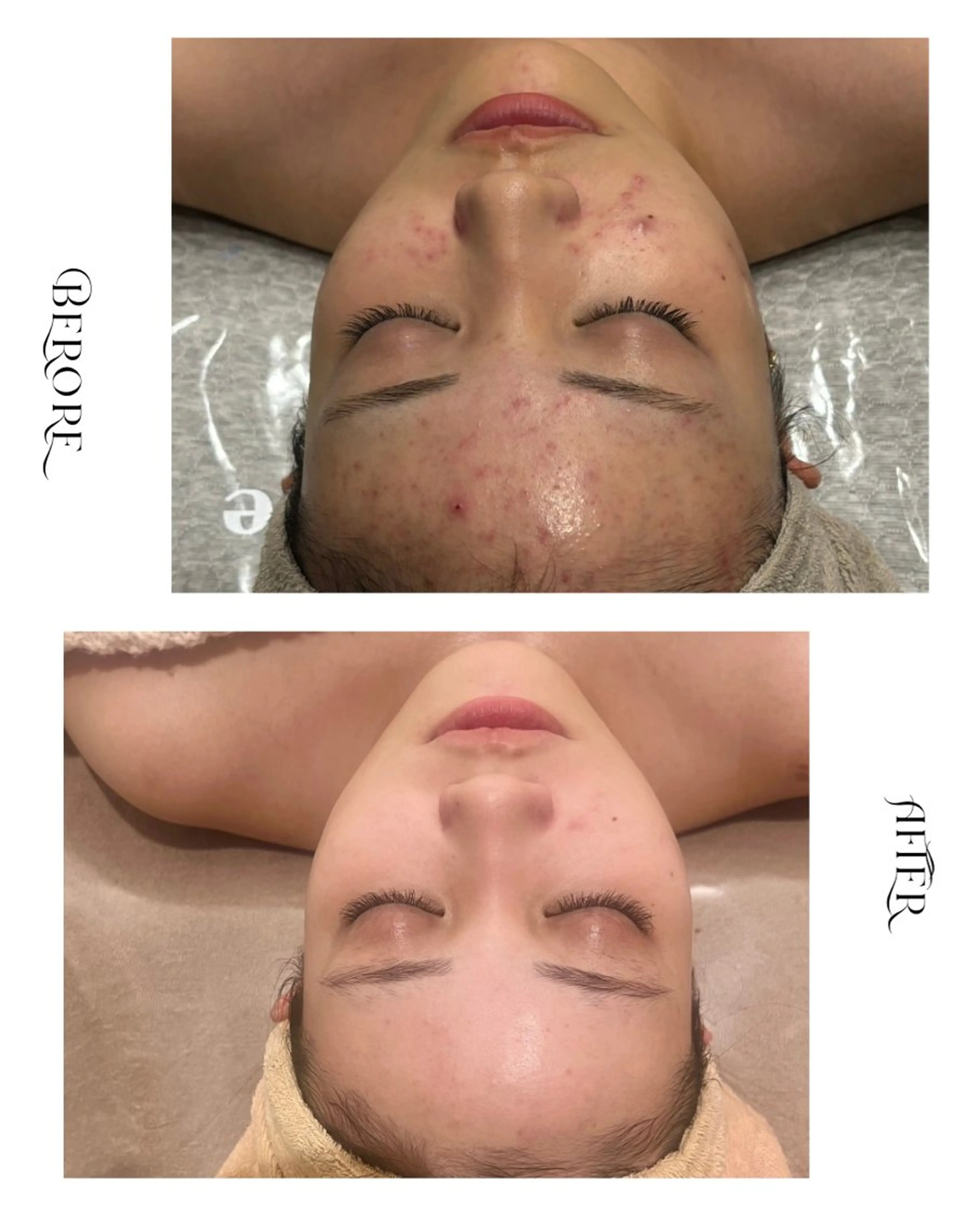 脱毛・肌質改善サロン Linoのエステ・リラクイメージ