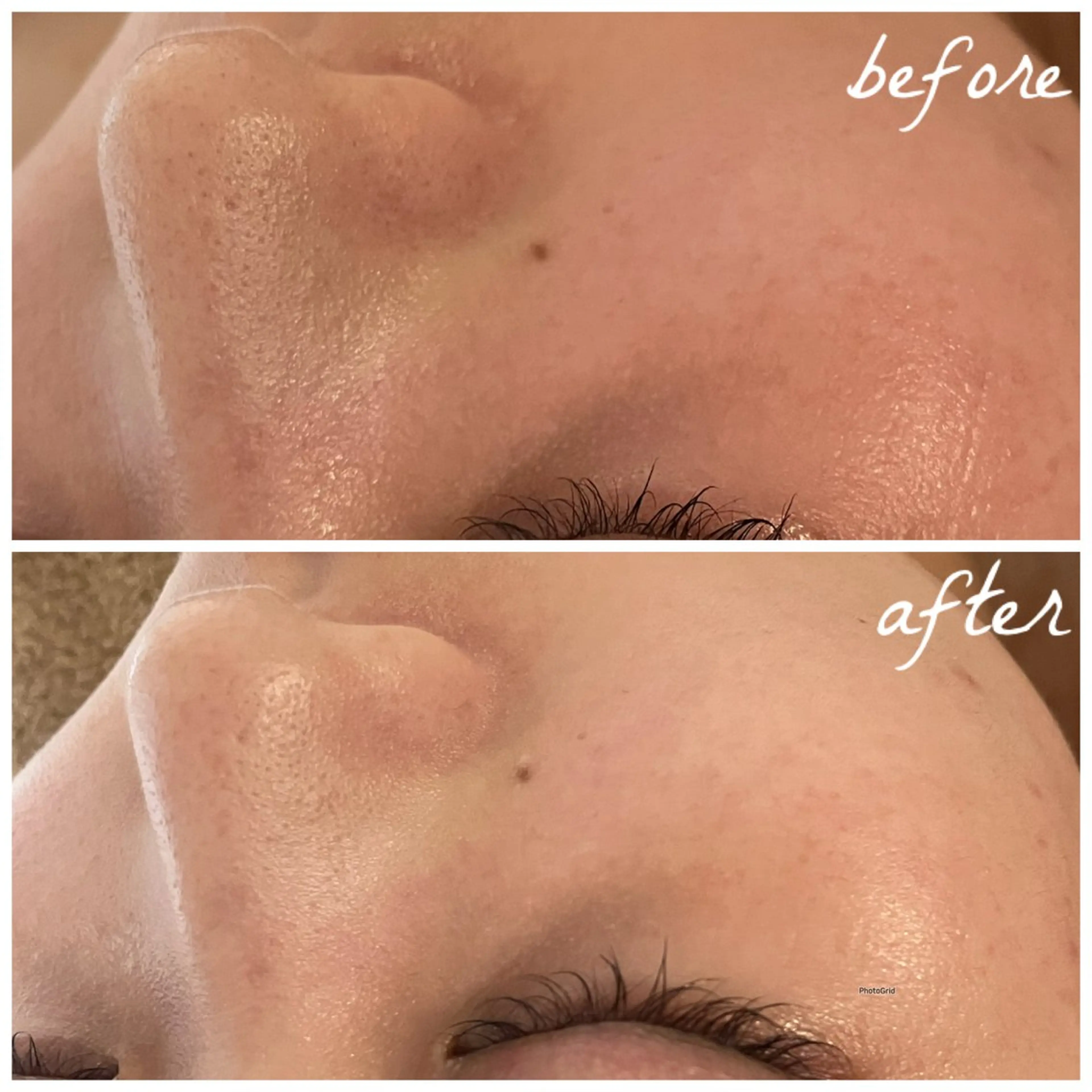 メンズ エステ メナード岐阜茜部 杉浦のエステ・リラクイメージ