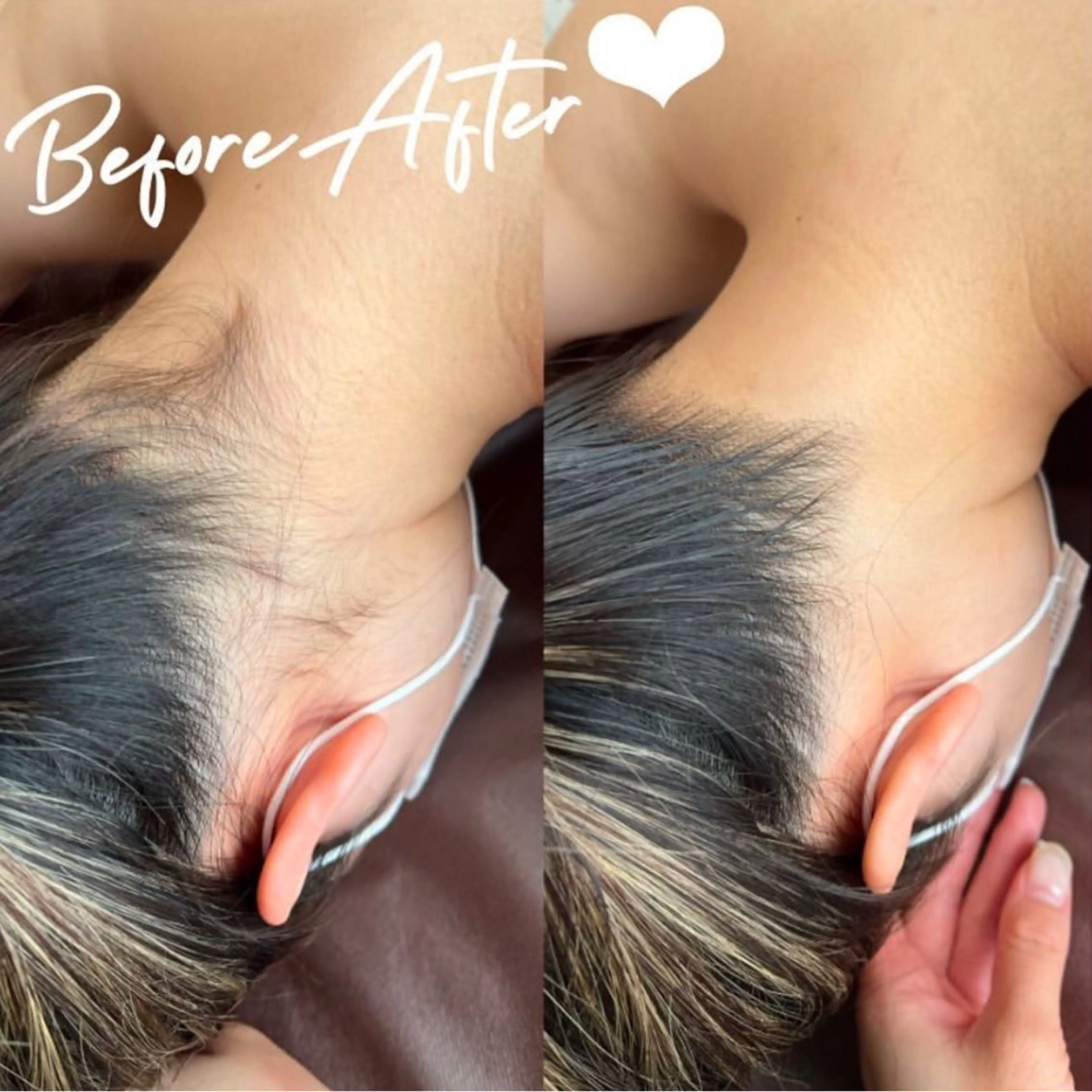 脱毛 エステサロン-mignon-所属・mignon 脱毛/ ローマピンク/耳ツボのその他イメージ