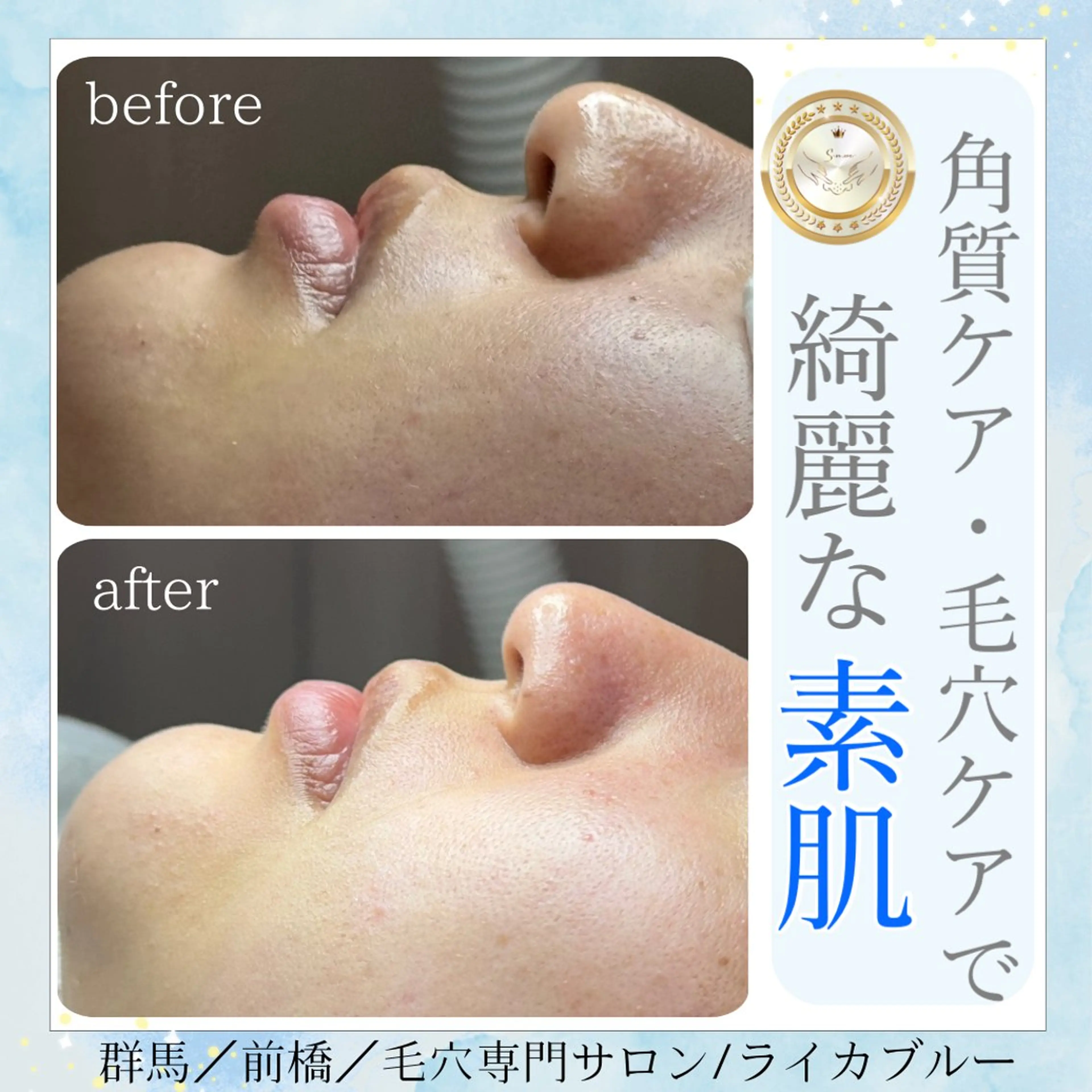 毛穴専門サロン ライカブルーのエステ・リラクイメージ