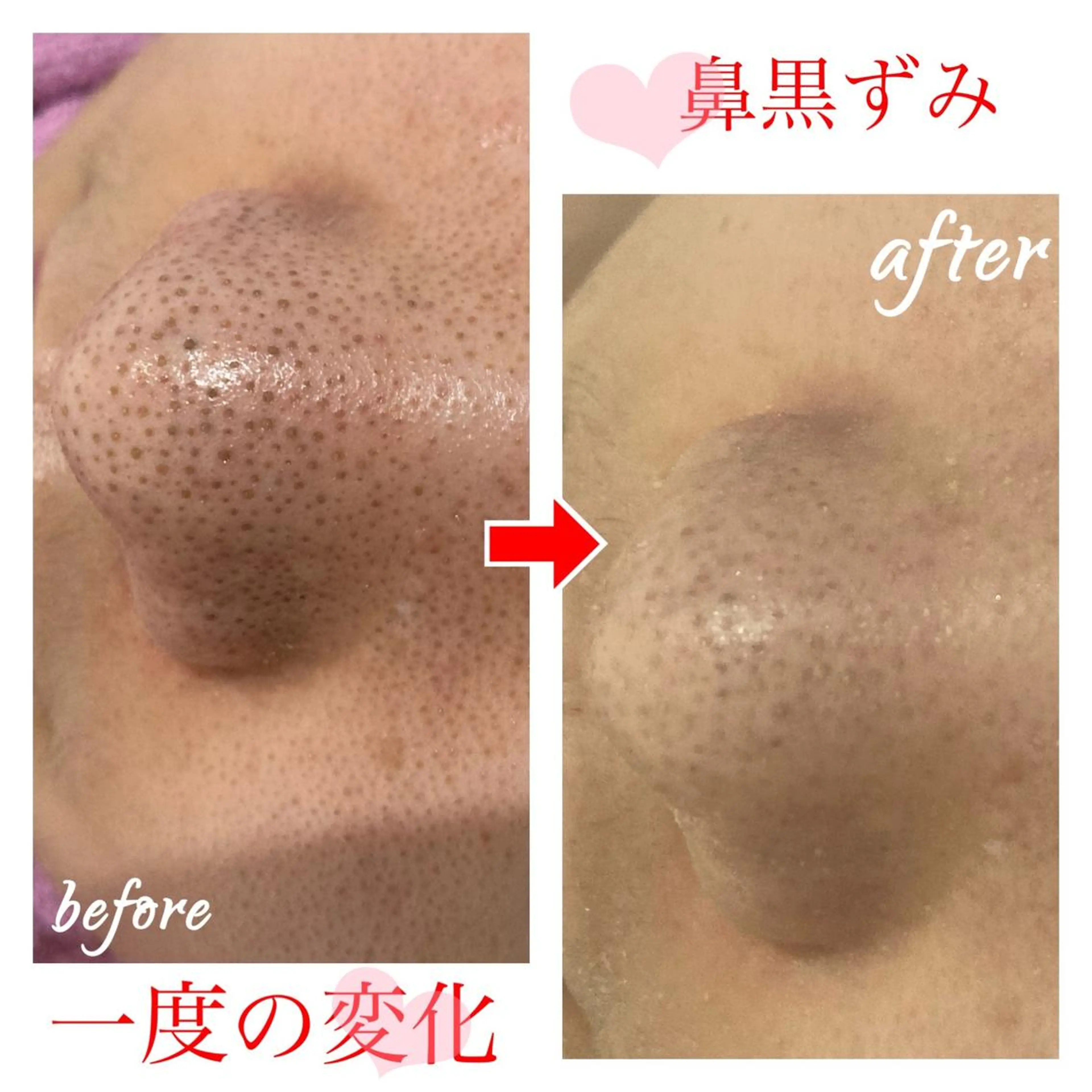 セミロング カラー パーマ ヘアアレンジ メンズ キッズ ネイル マツエク・マツパ 四つ星サロン🎖 腸＆ニキビケアに特化のエステ・リラクイメージ