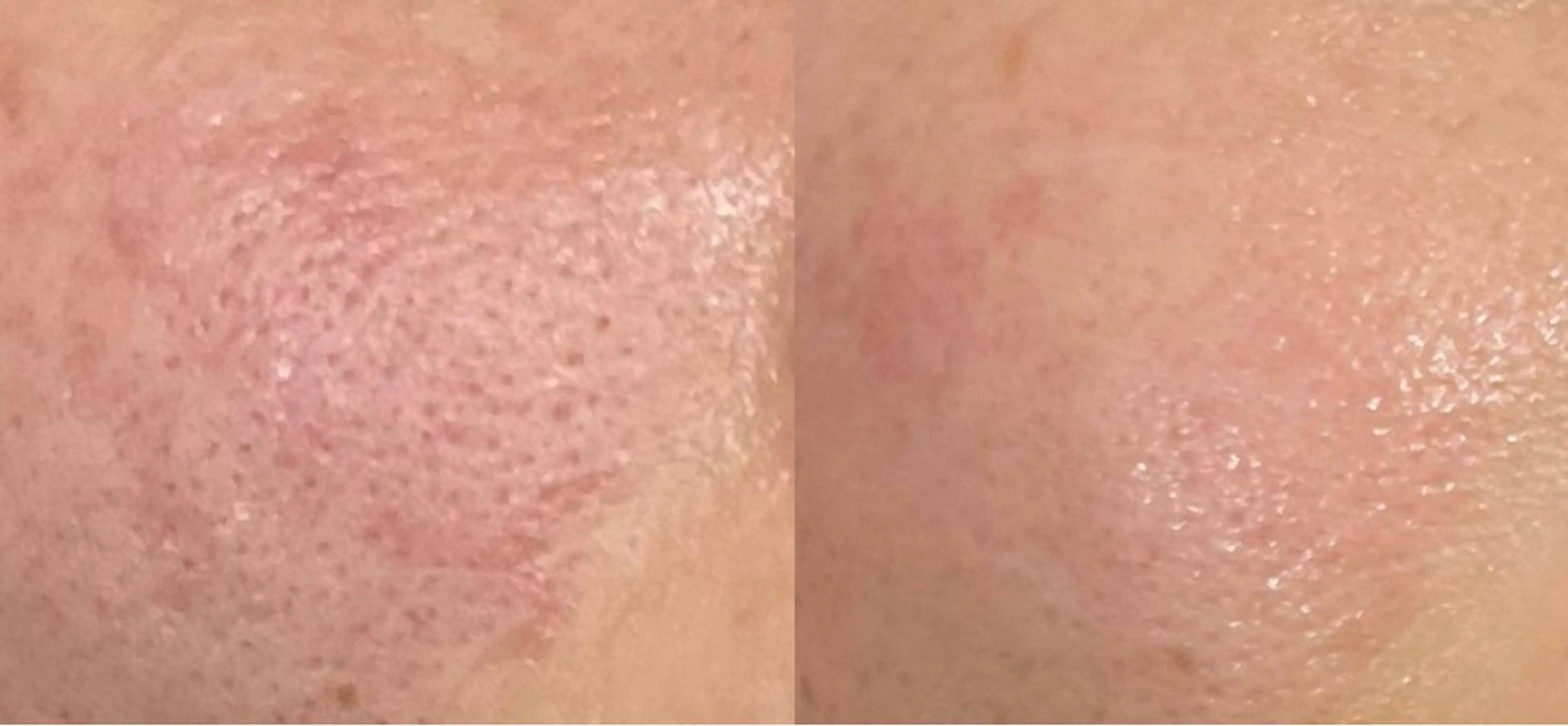 Rassurer 山本のエステ・リラクイメージ