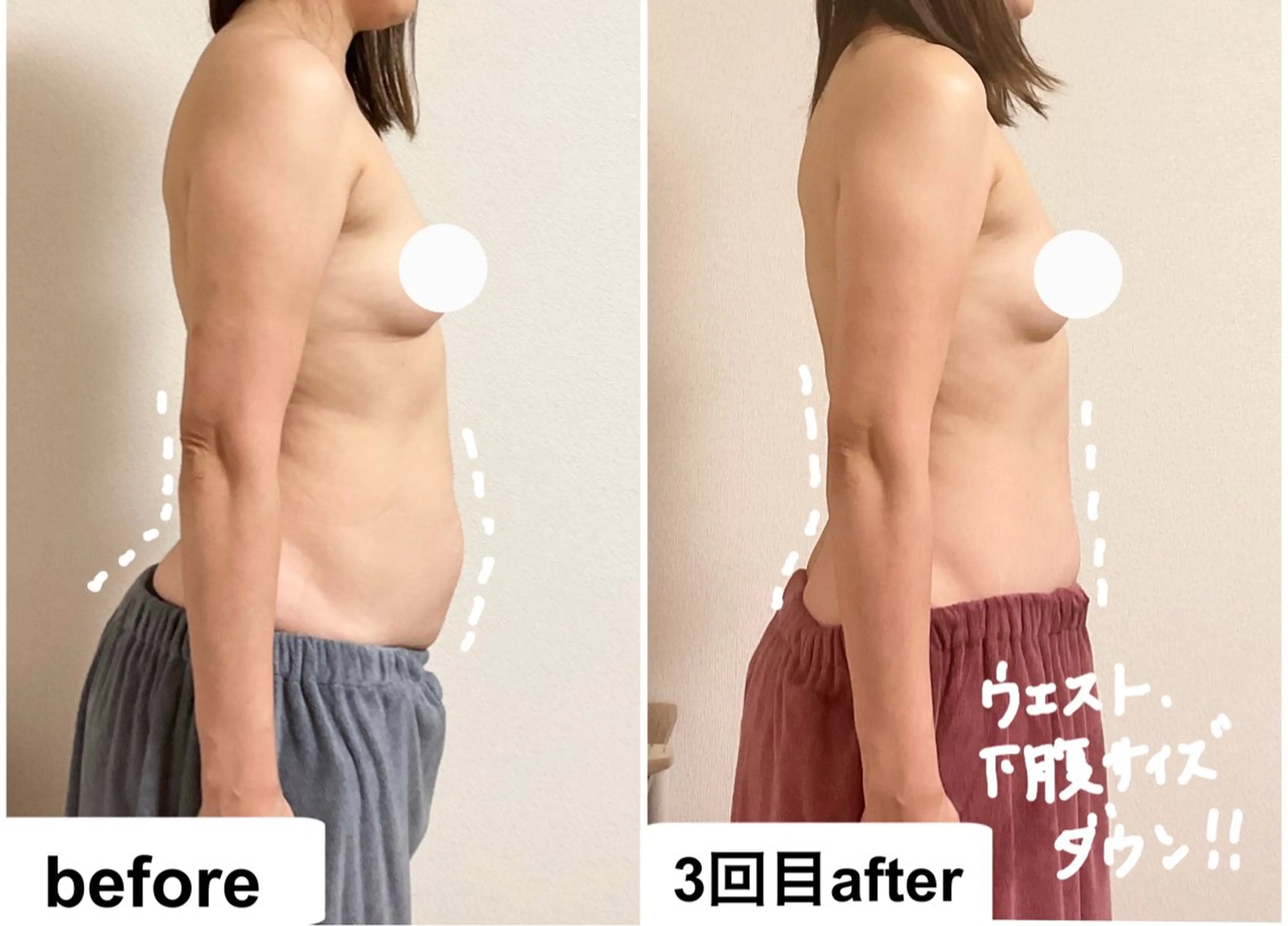 【これが私？！】お腹背中キャビ&バストアップで脂肪デザイン☆上半身美ボディ90分の写真