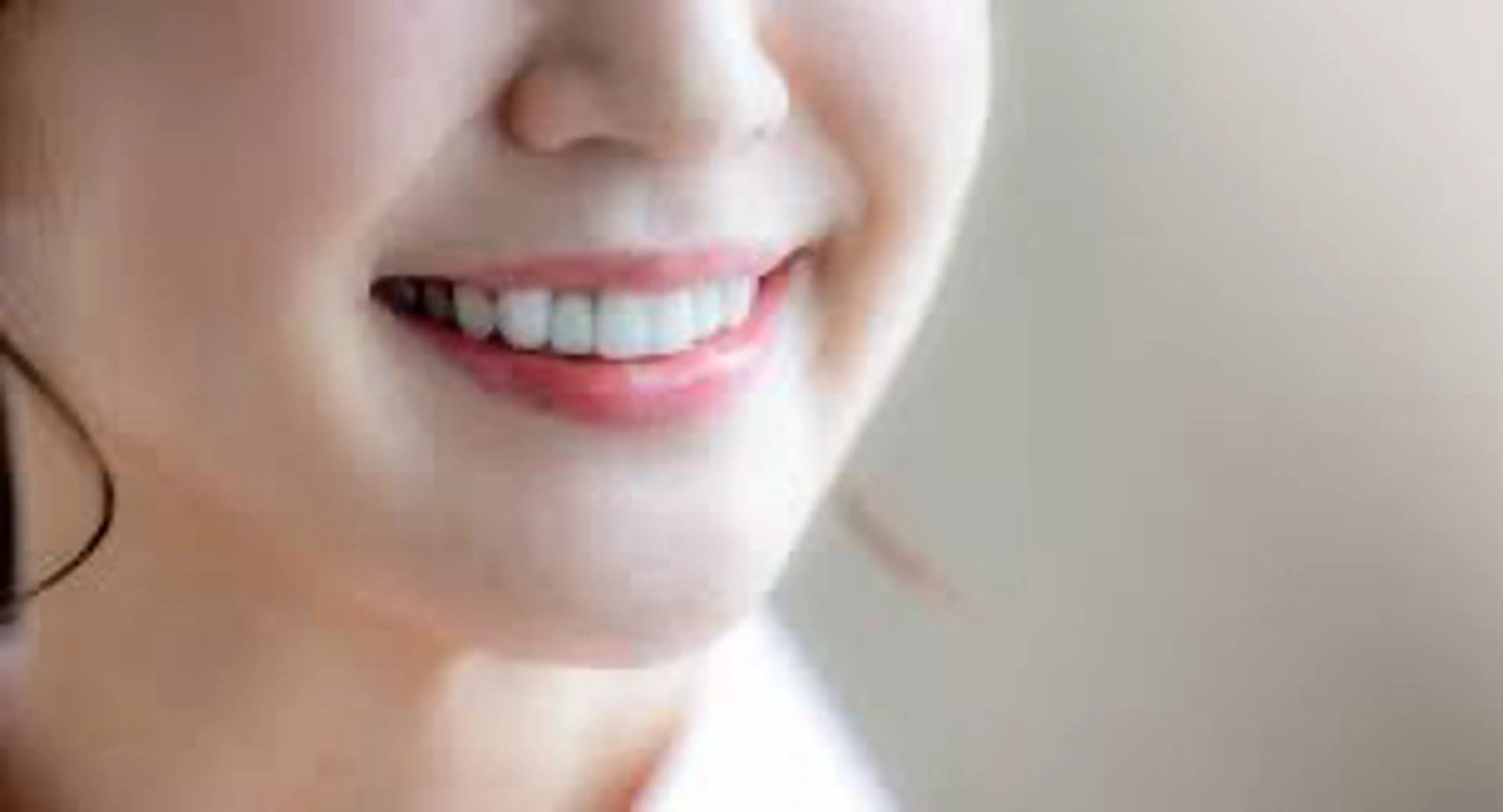 ecxia white 高田馬場所属・セルフホワイトニング エクシア 高田馬場のその他イメージ