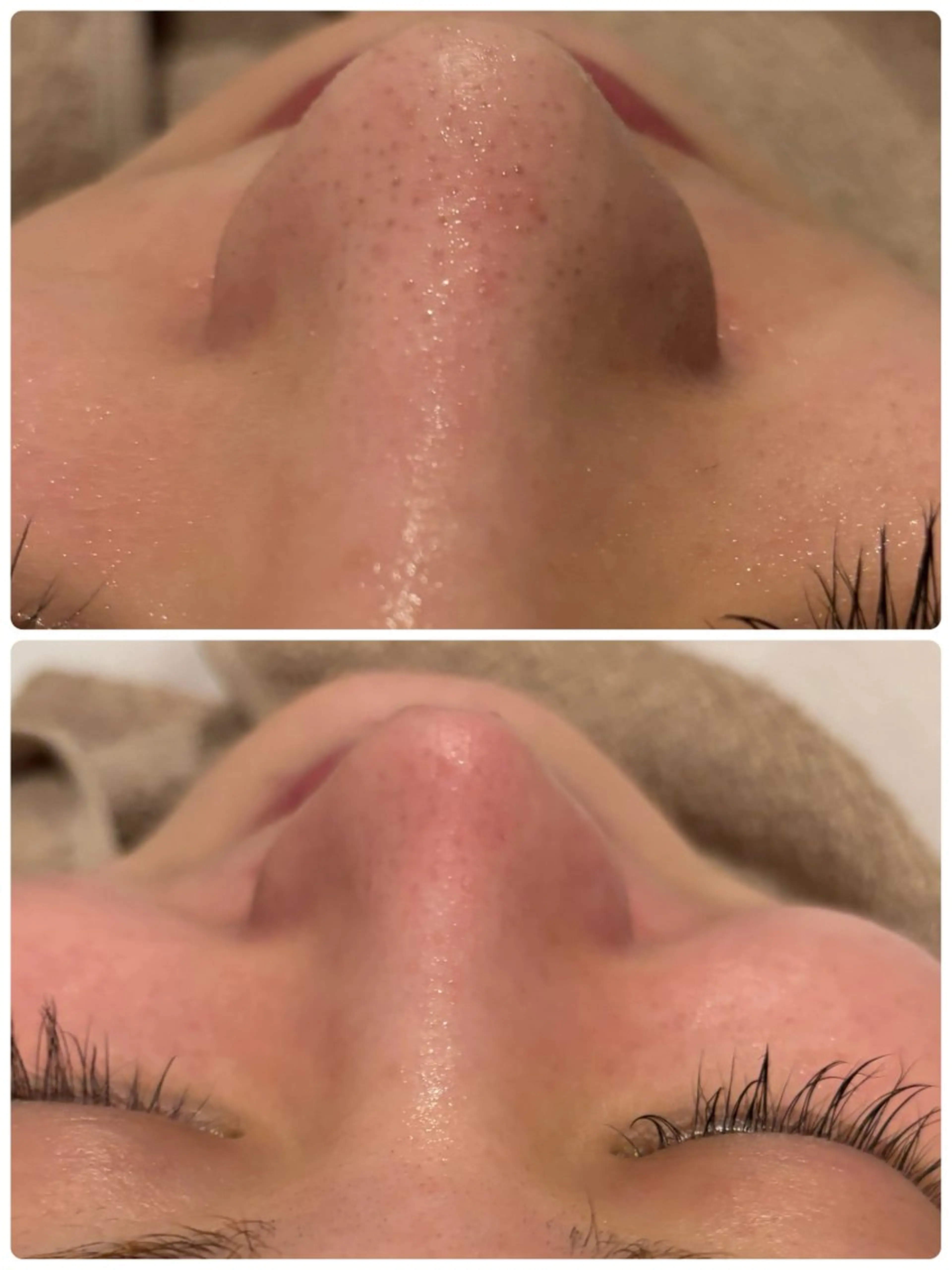 エステ 【リベルハーブピーリング認定店】敏感肌・美白脱毛専門店Dione立川店所属・Dione 立川店のエステ・リラクイメージ