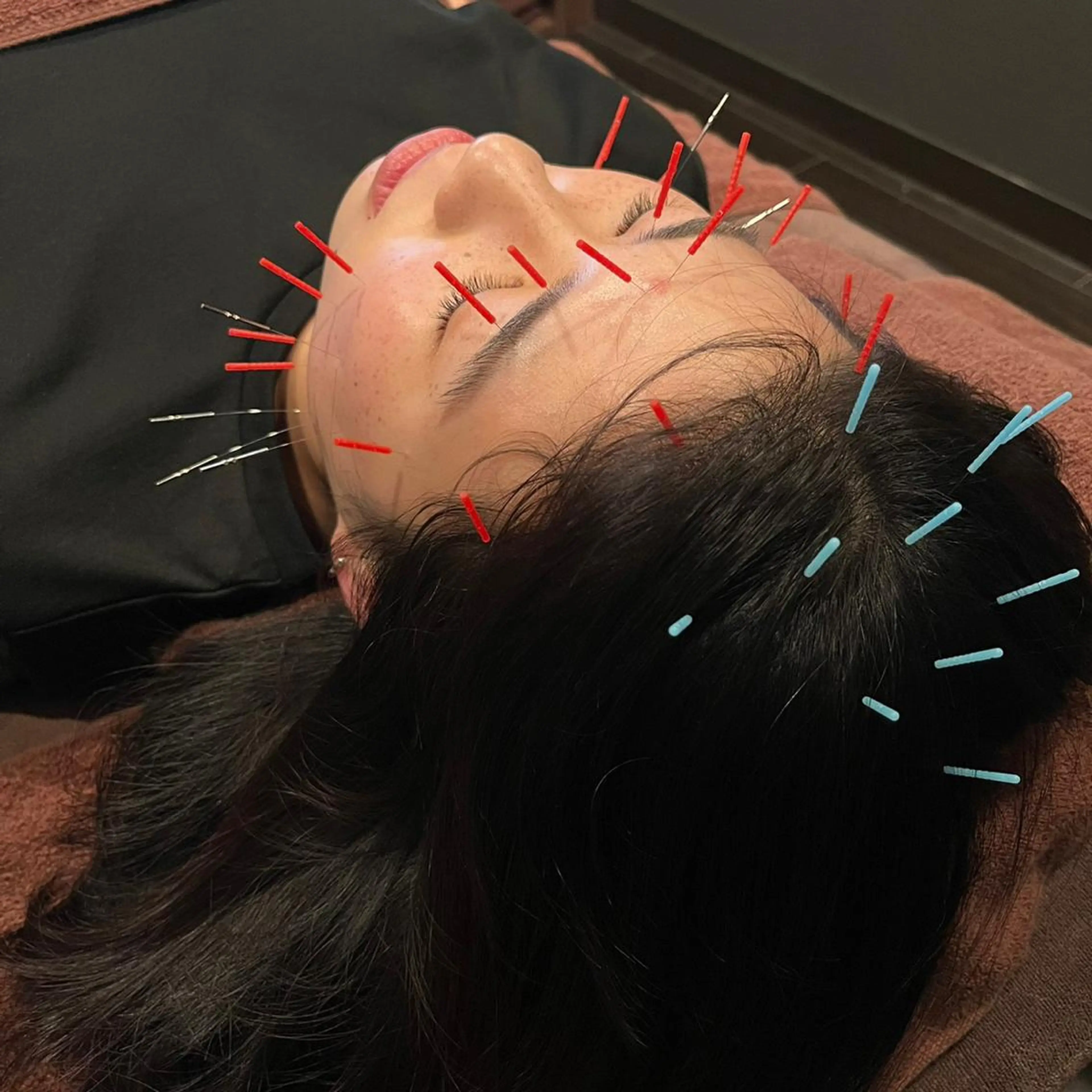 小林整骨院玉川 キジマのエステ・リラクイメージ