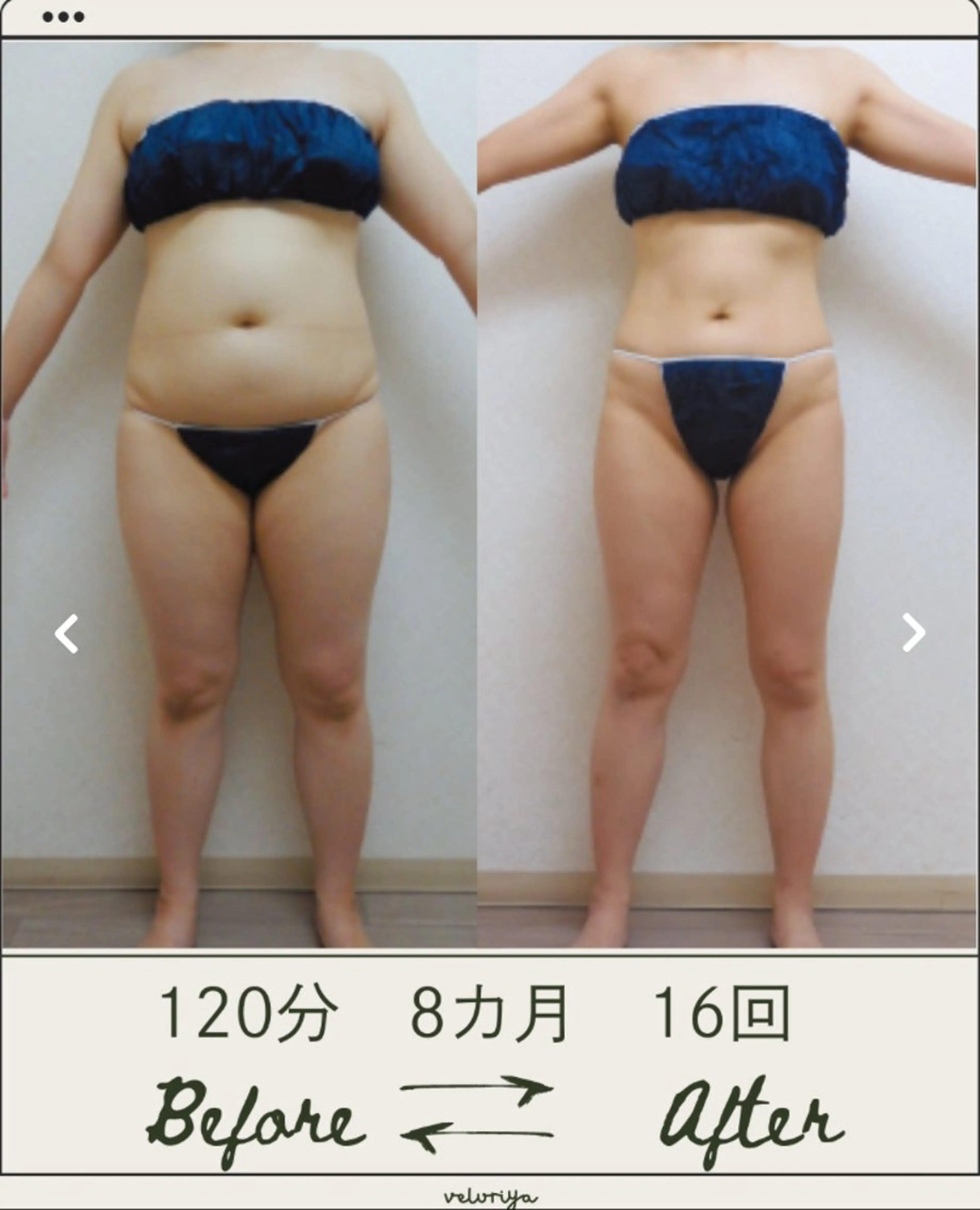 ヴェルーリヤ ビューティーデザインのエステ・リラクイメージ