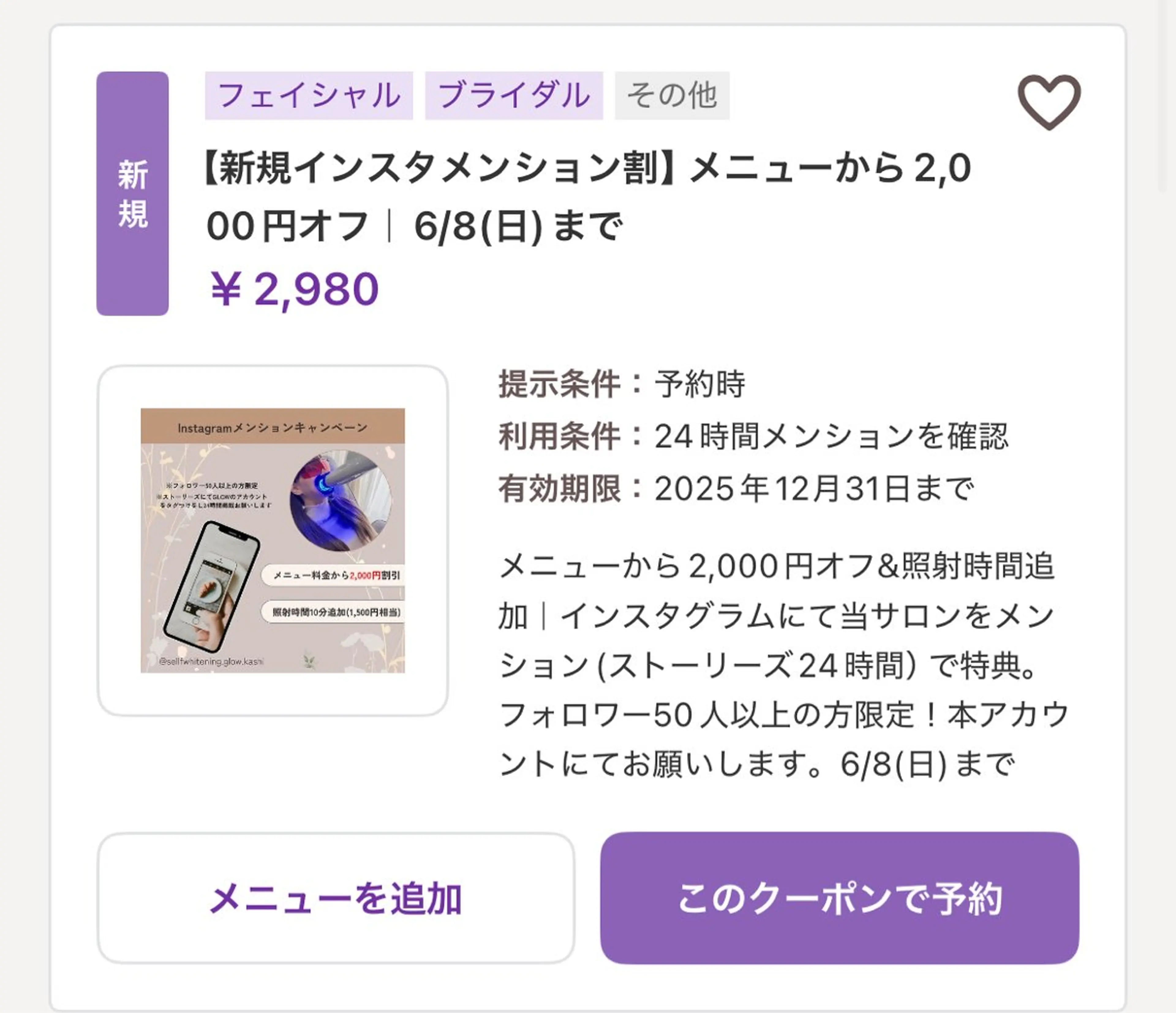 歯のセルフホワイトニング専門店GLOW（グロウ）所属・東区香椎歯のセルフホ ワイトニングGLOWのその他イメージ