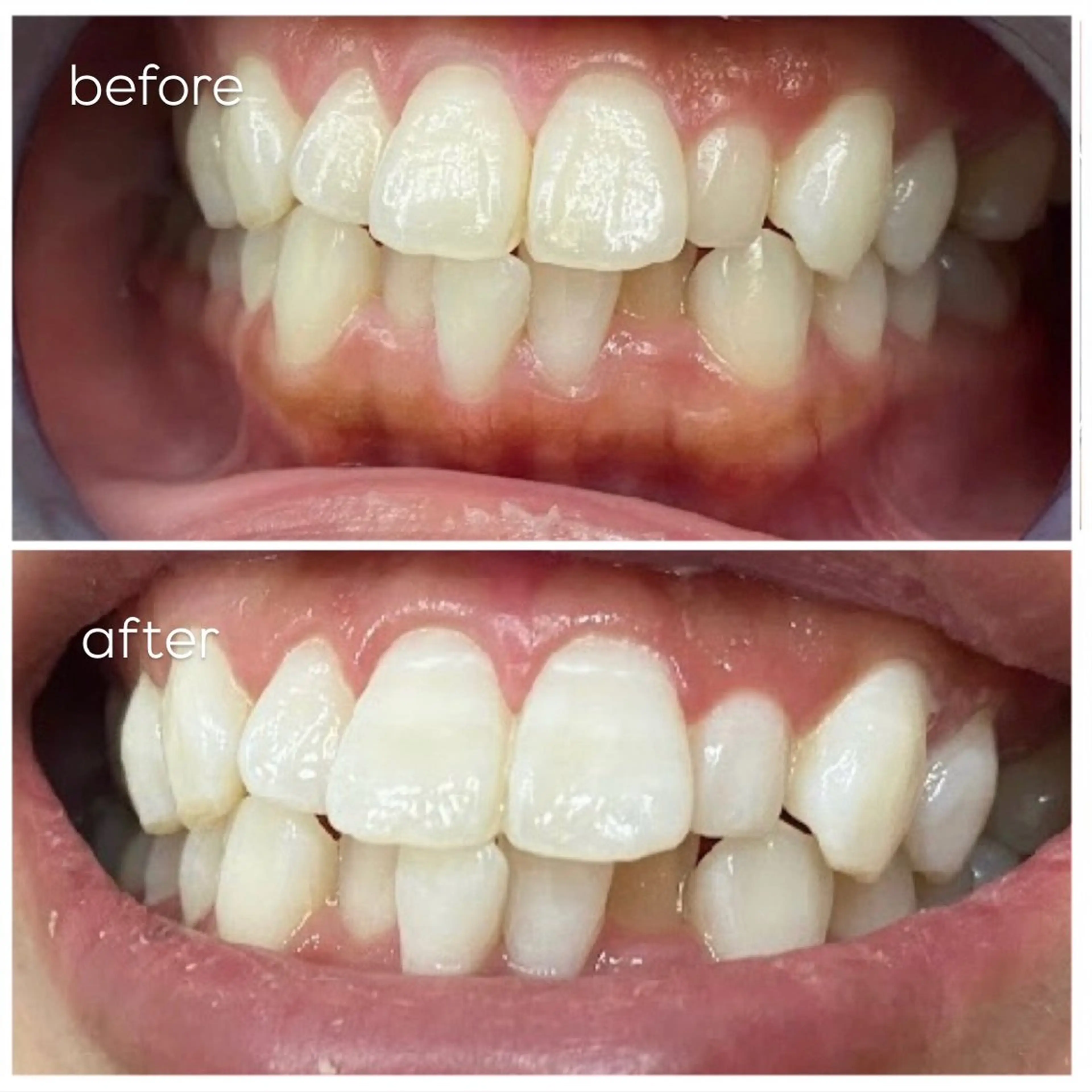 エクシア津駅前店所属・セルフホワイトニング エクシア津駅前店のその他イメージ