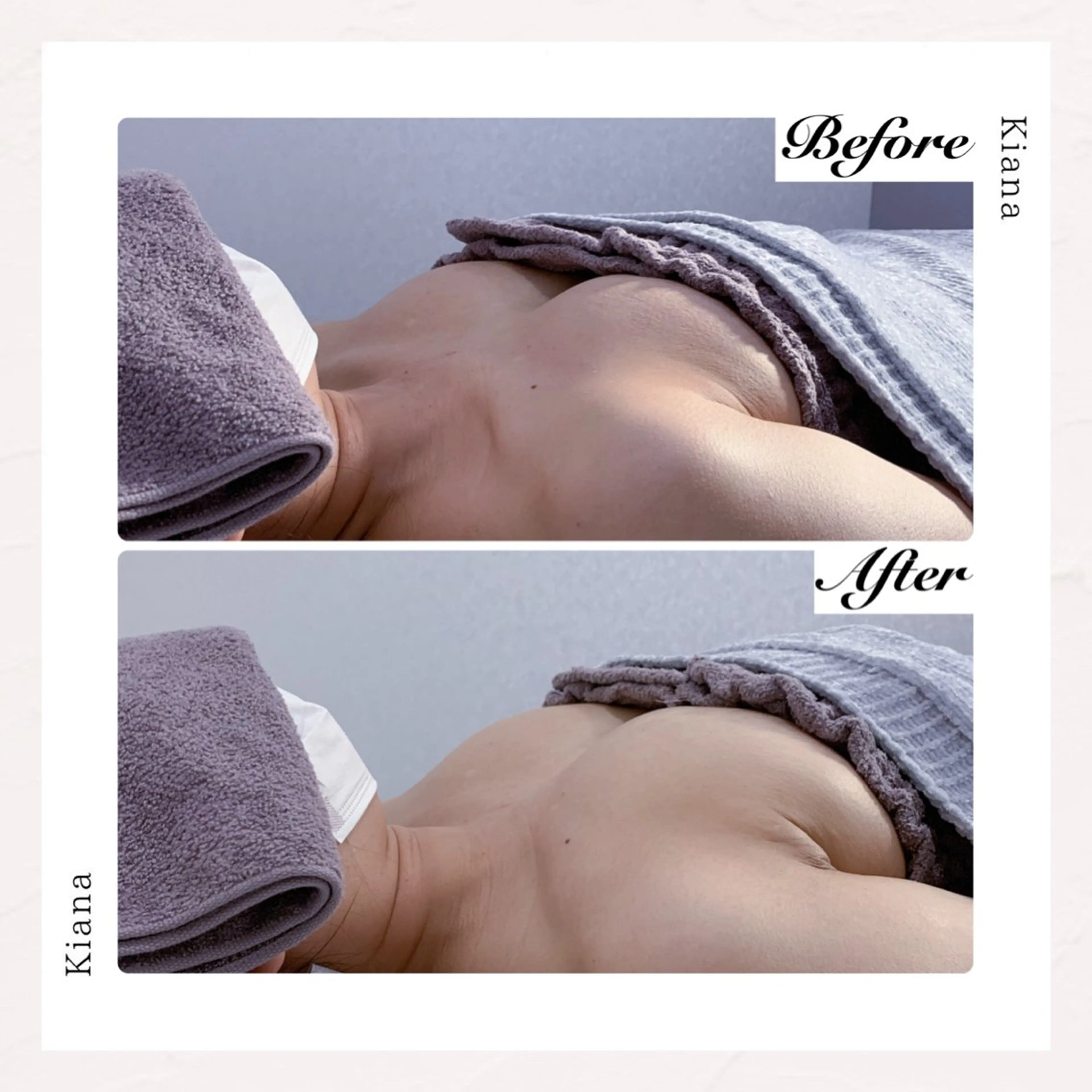 バスト専門Kiana 風のエステ・リラクイメージ