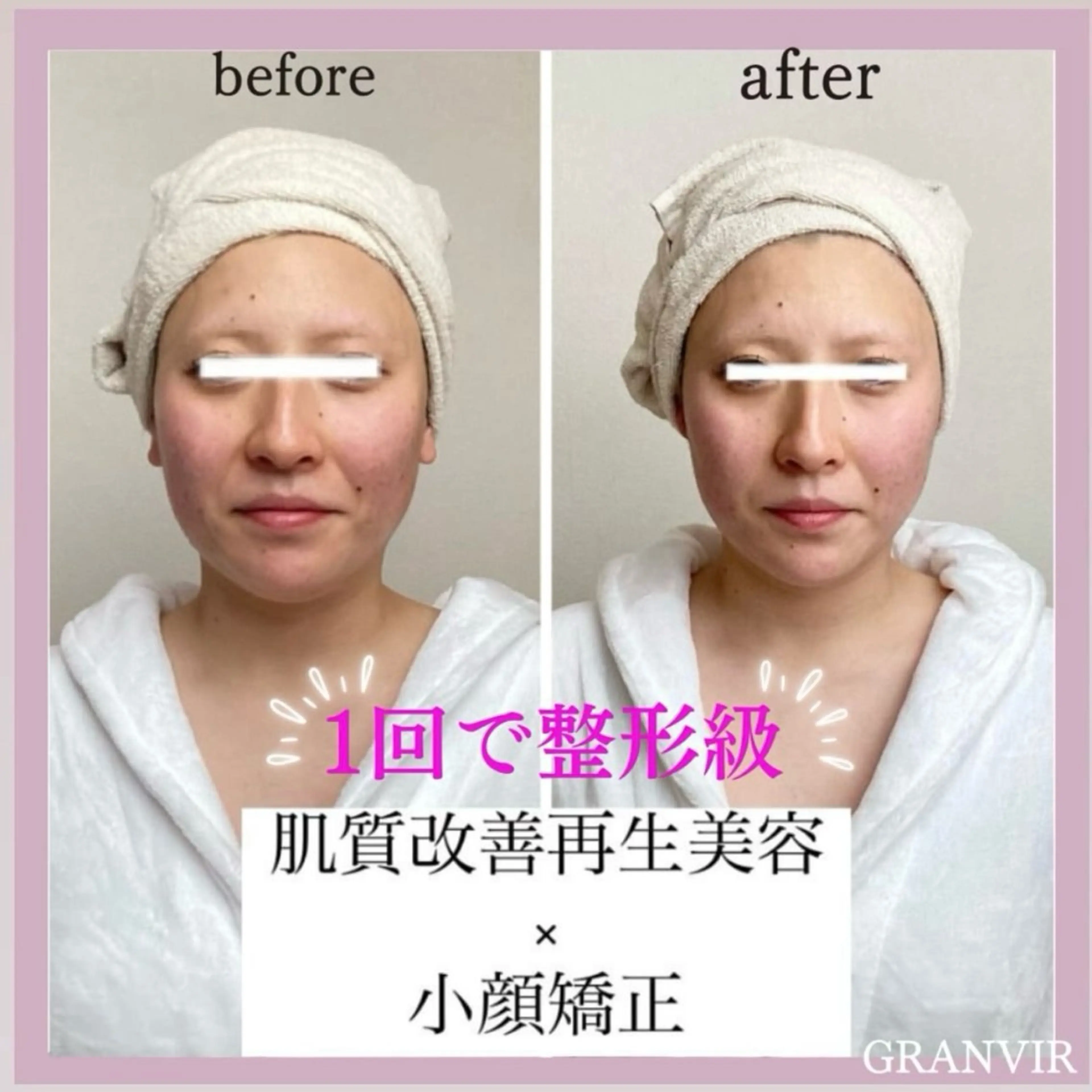 【福岡市西区 エステ】 GRANVIR(グランヴィール)所属・GRANVIR グランヴィールのエステ・リラクイメージ