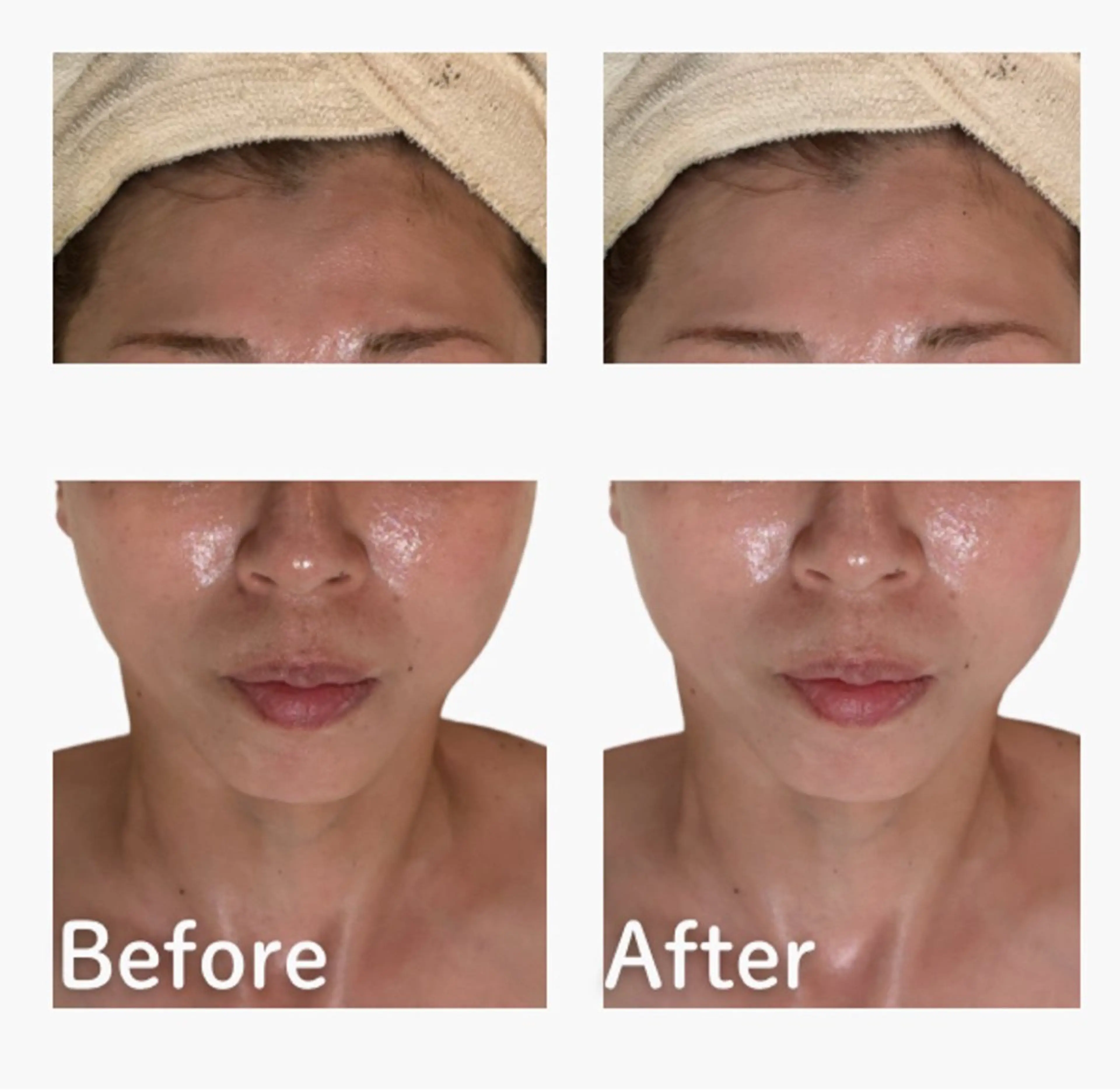 、 、‪‪のエステ・リラクイメージ