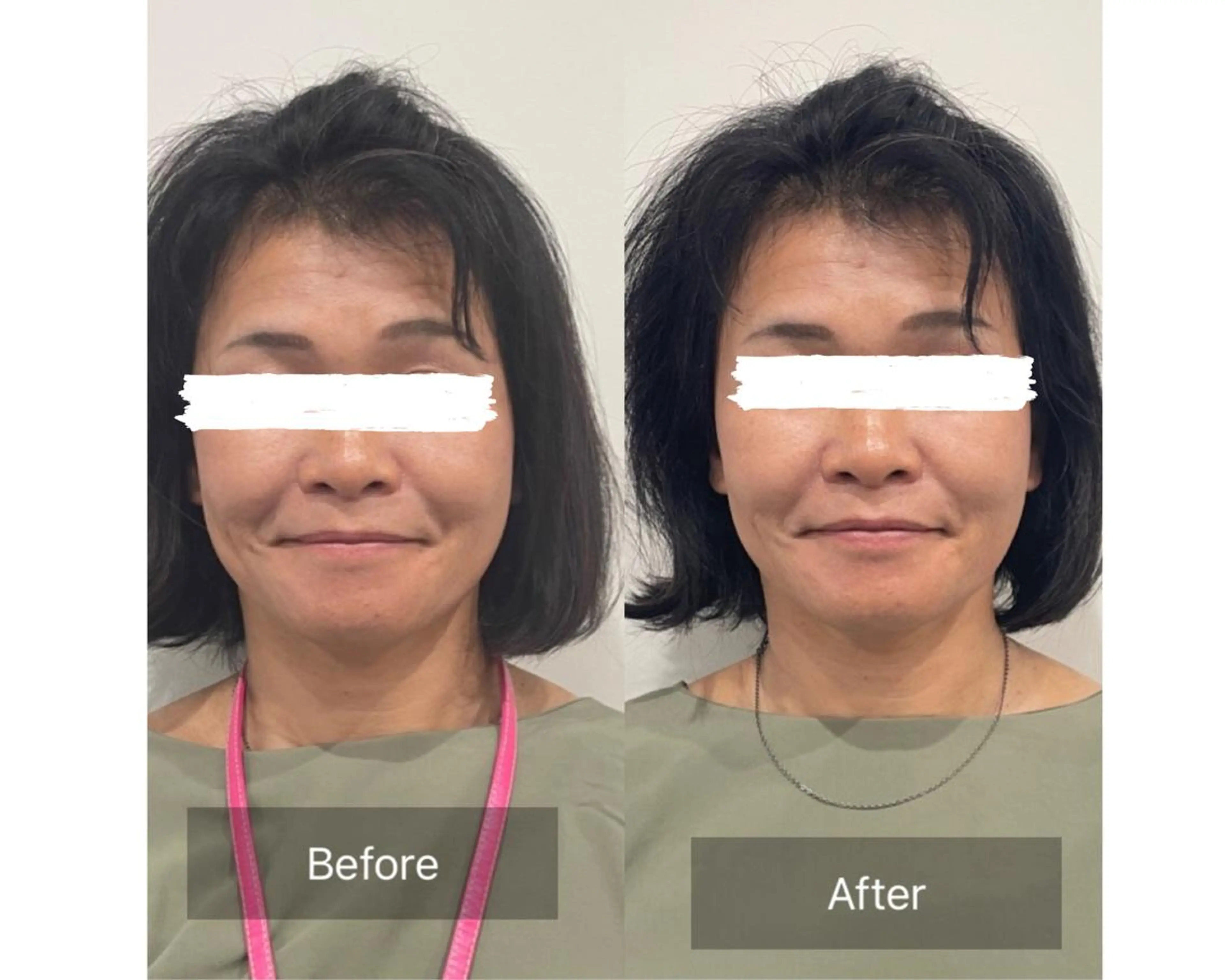 Loa Chaton YUMIのエステ・リラクイメージ