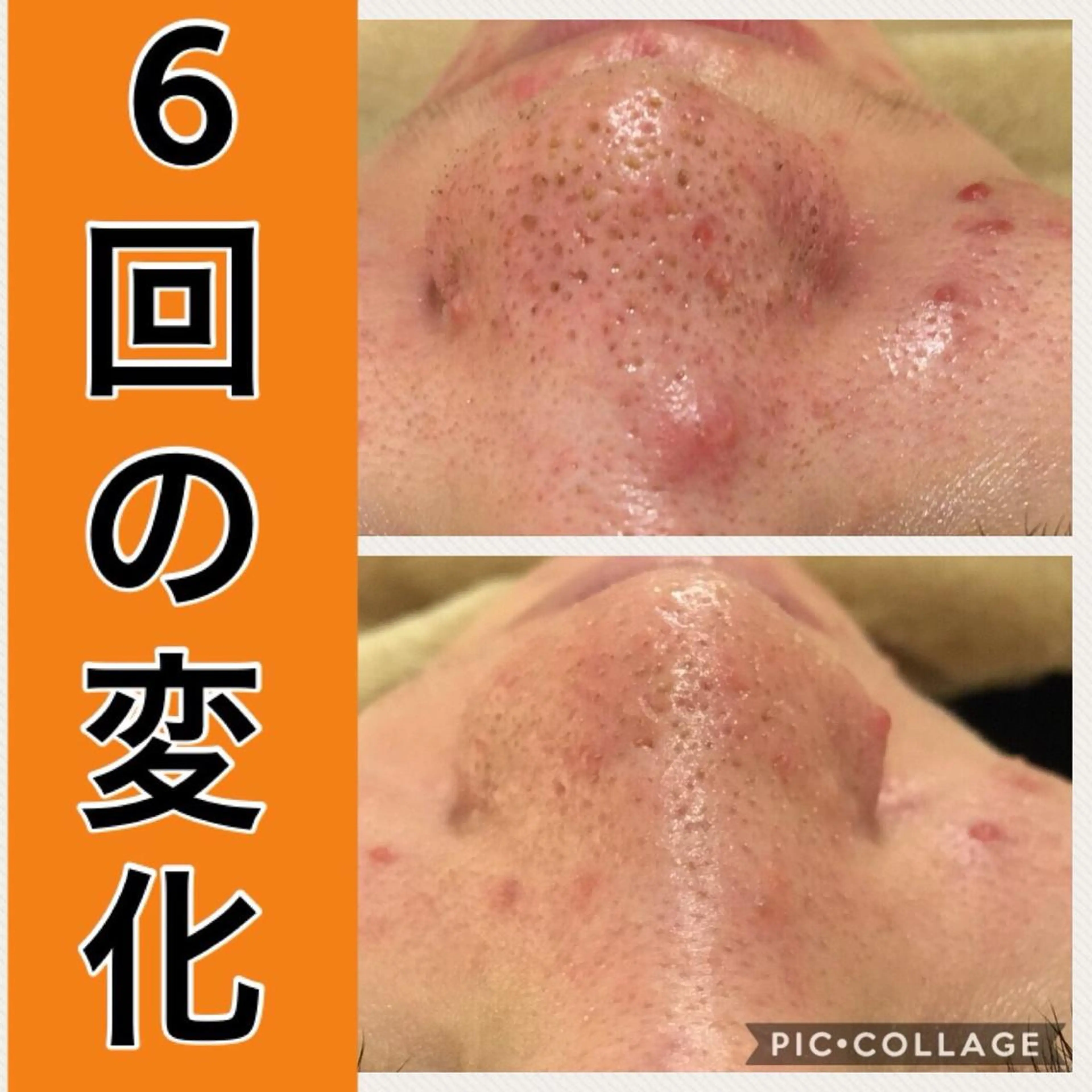 ミディアム パーマ ヘアアレンジ メンズ キッズ ネイル マツエク・マツパ ニキビ・肌質改善専門 ♡人生が変わるサロンのエステ・リラクイメージ