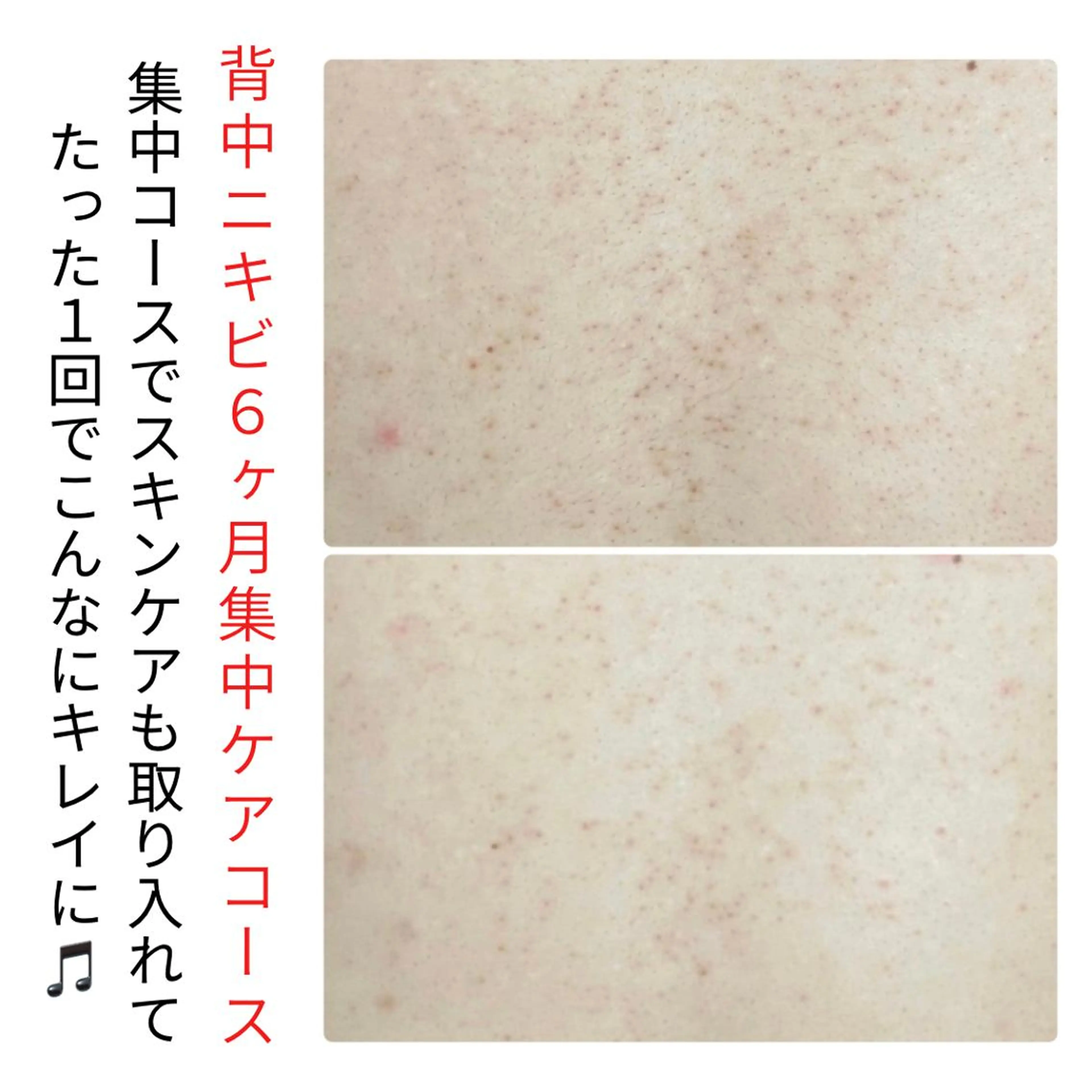 ベラージュ【美背中・ 美尻・フェイシャル】のエステ・リラクイメージ