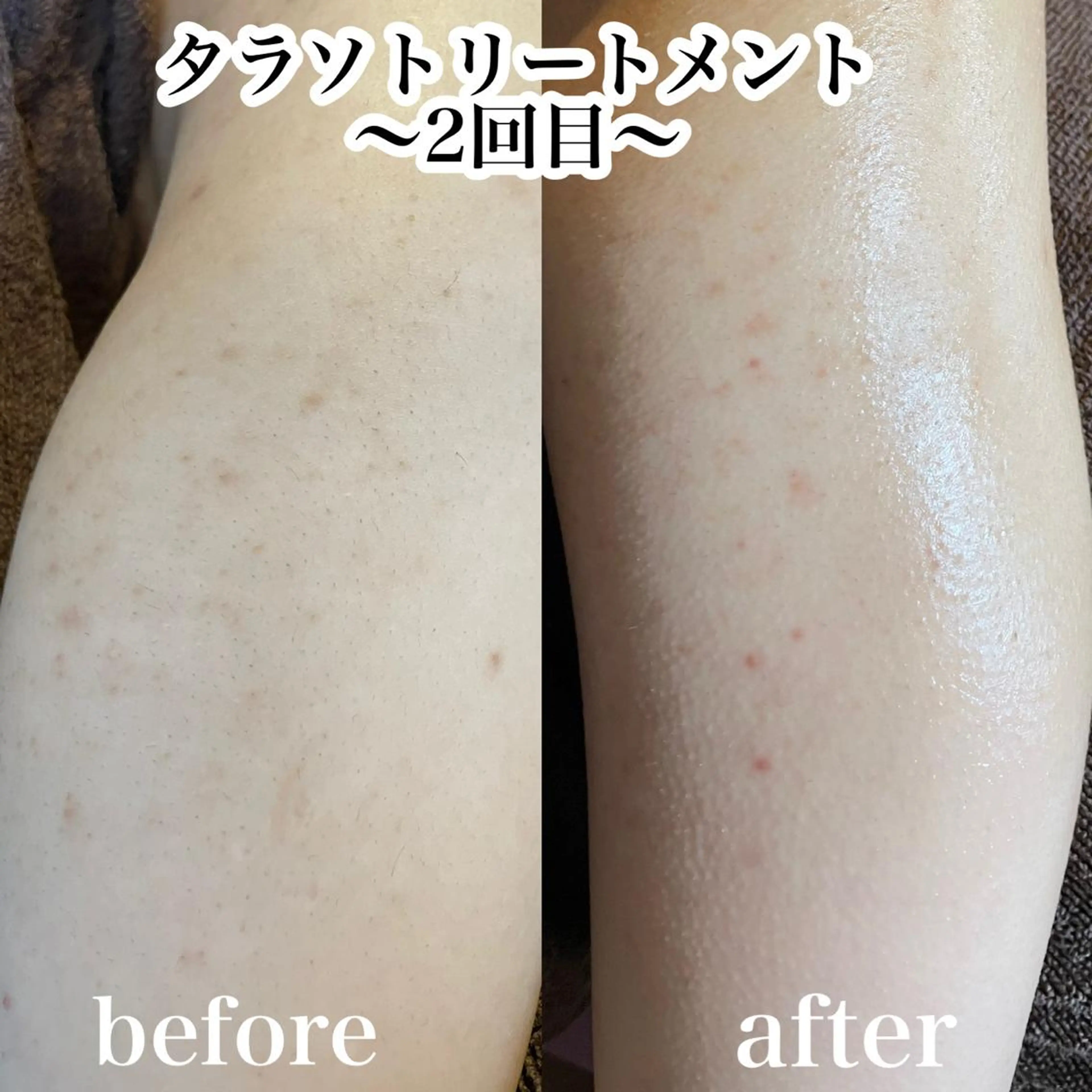 エステ 浜野 恵美のエステ・リラクイメージ